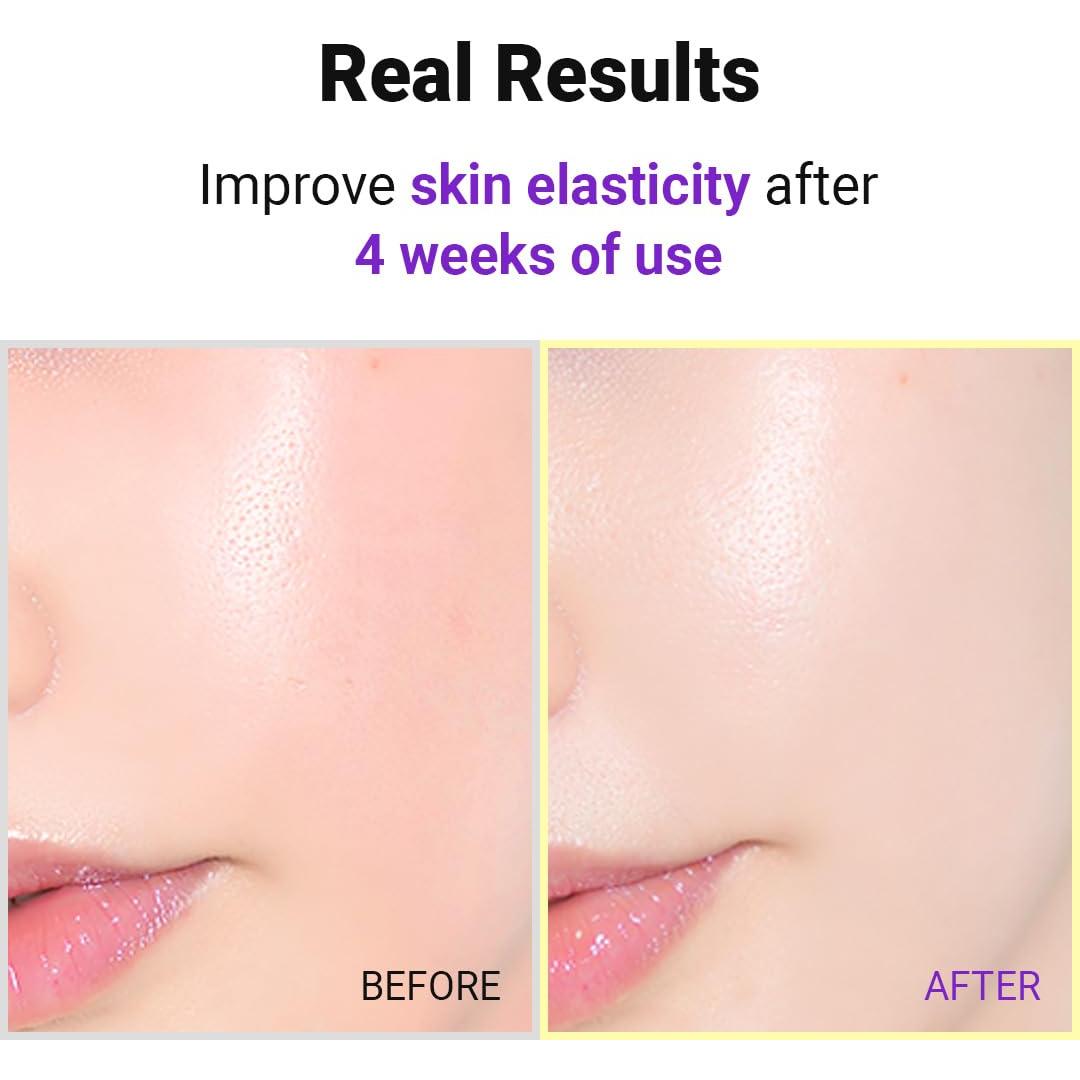 Suero ISNTREE Hyper Retinol EX 20ml | 5 Péptidos | 5 Ceramidas