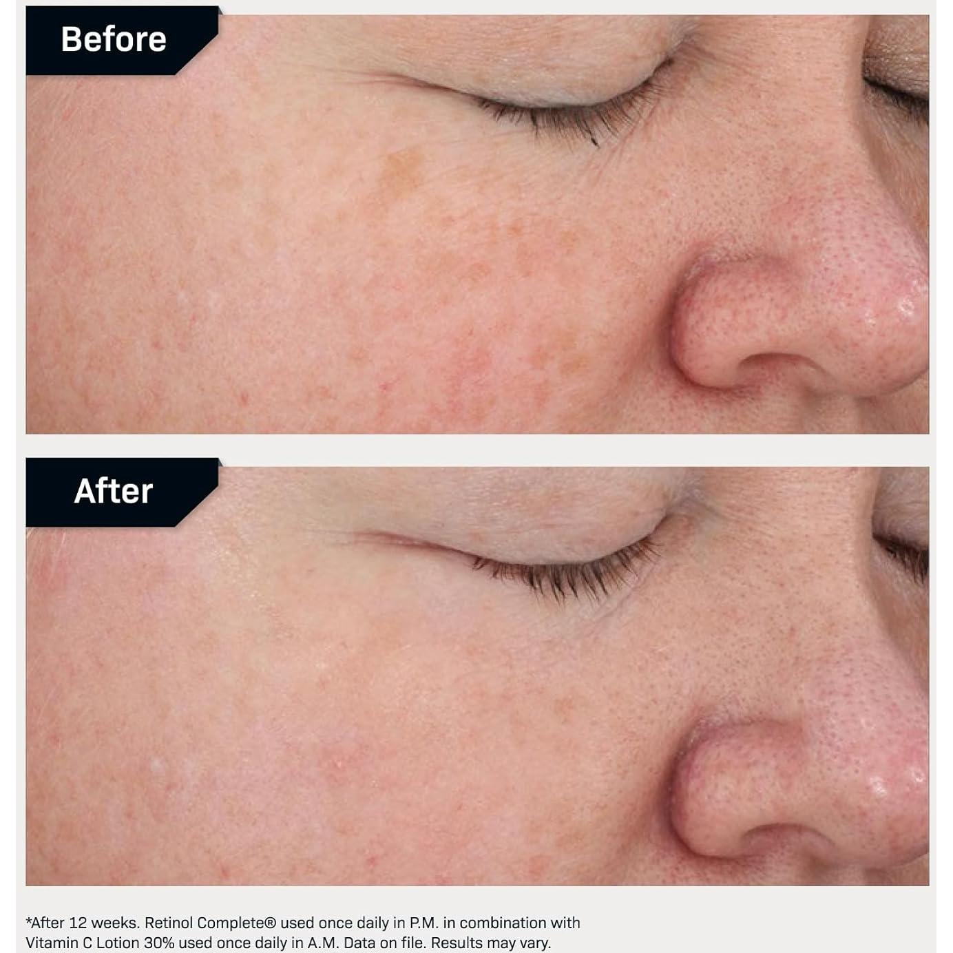 Suero Anti Envejecimiento Retinol 0.5 Revision Skincare 29.57 ml