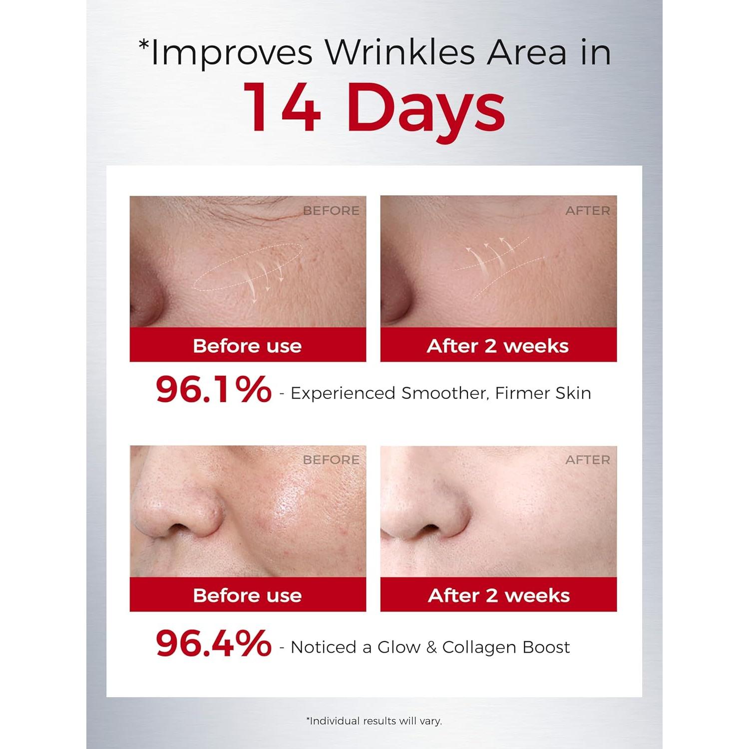 Suero de Retinol NING DERMOLOGIE 30ml - Antienvejecimiento y Péptidos