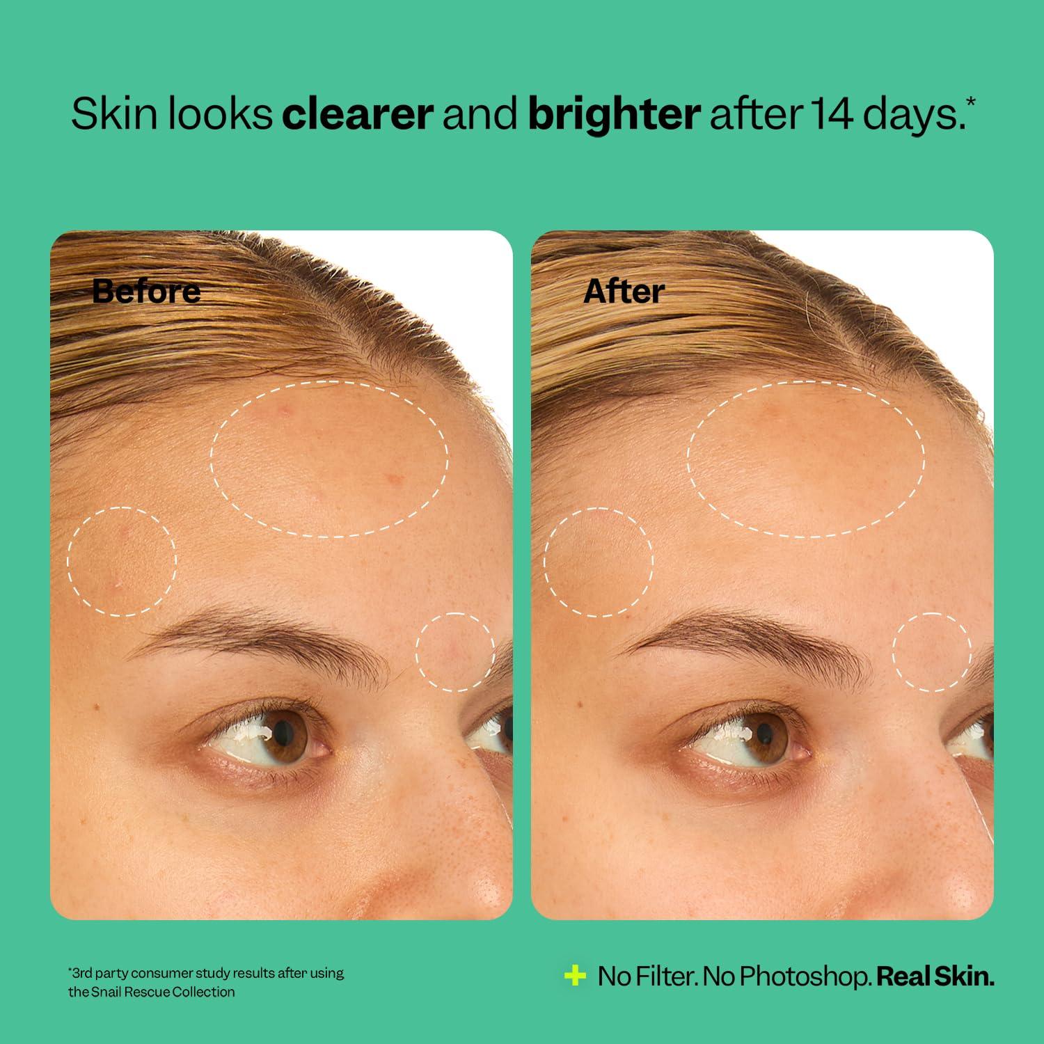 Suero Intensivo Hidratante Peach & Lily 95% Mucina Caracol