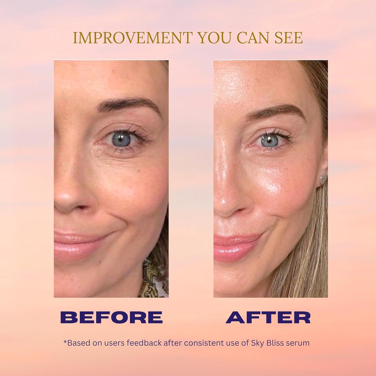 Suero Facial Sky Bliss 4 en 1 | Ácido Hialurónico, Vitamina C, E y Niacinamida | Antienvejecimiento