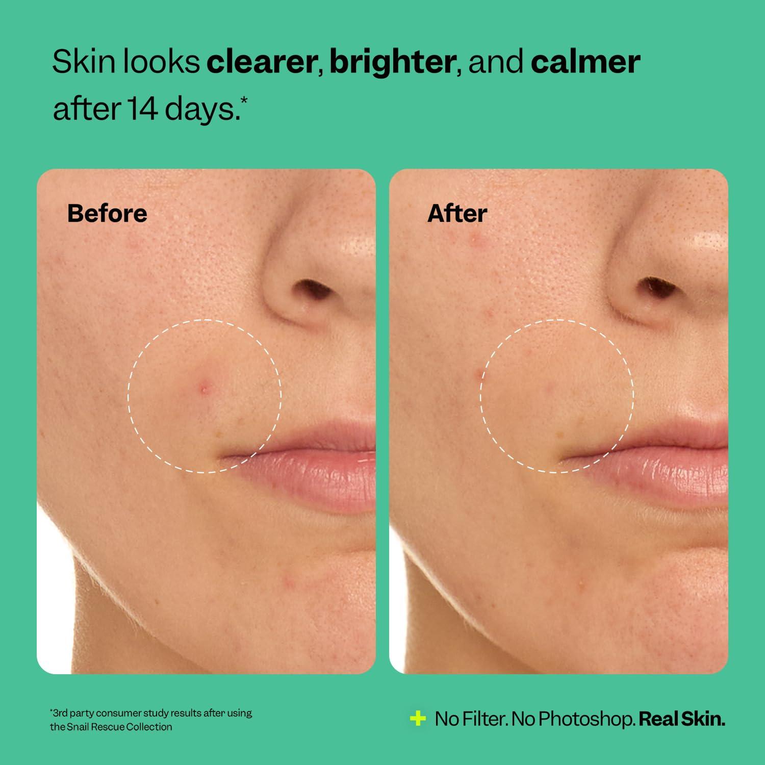 Limpiador Purificante Peach & Lily Rescate de Caracol 120 ml