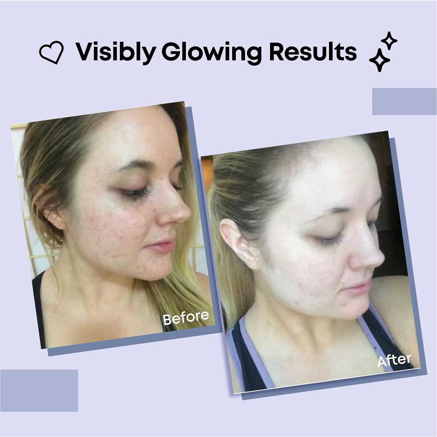 Mascarilla Facial de Colágeno Bayside - Hidratante 10 Piezas