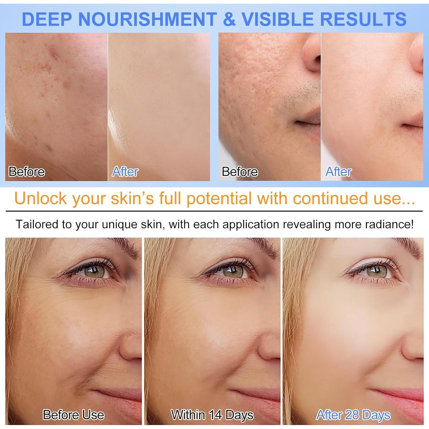 Mascarilla Facial de Colágeno SOLOTREE Hidrogel 6PCS