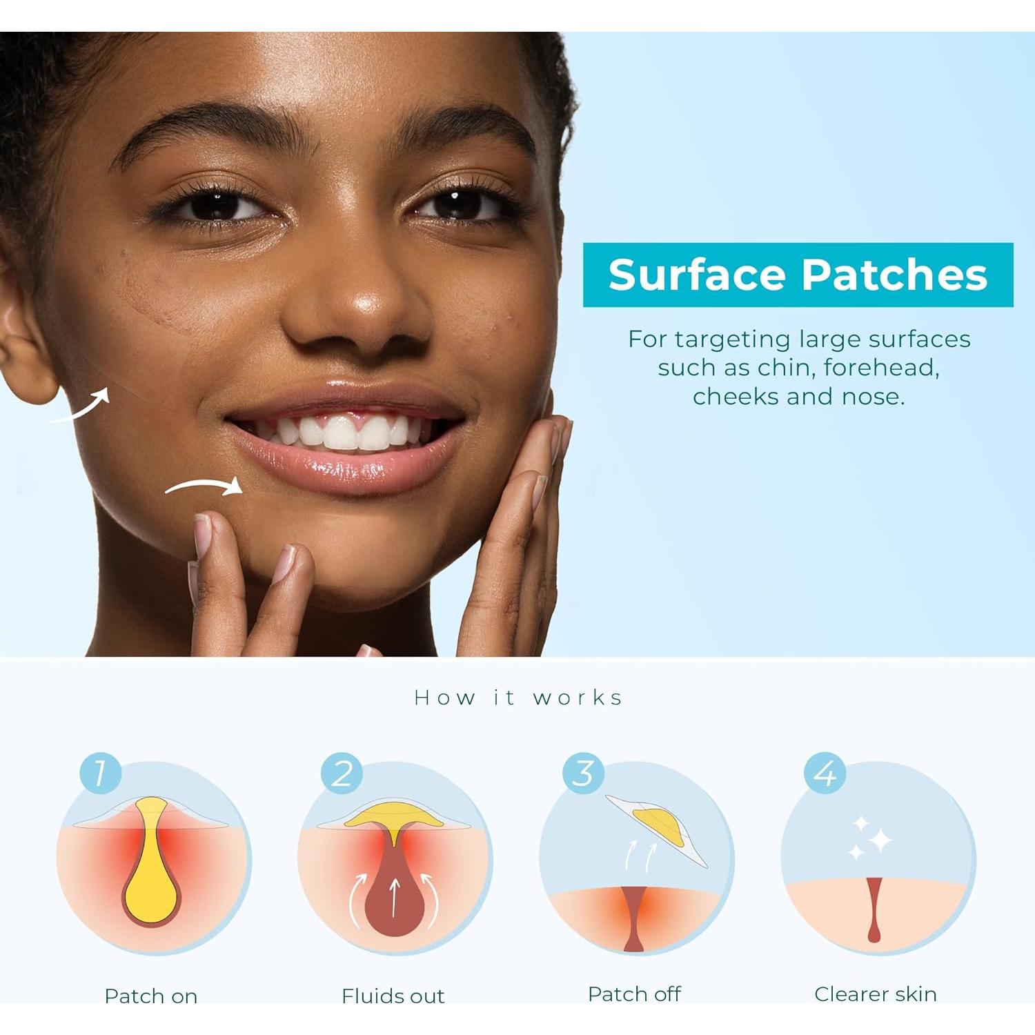 Parche Hidrocoloide para Acné Vegano 10 Unidades XL