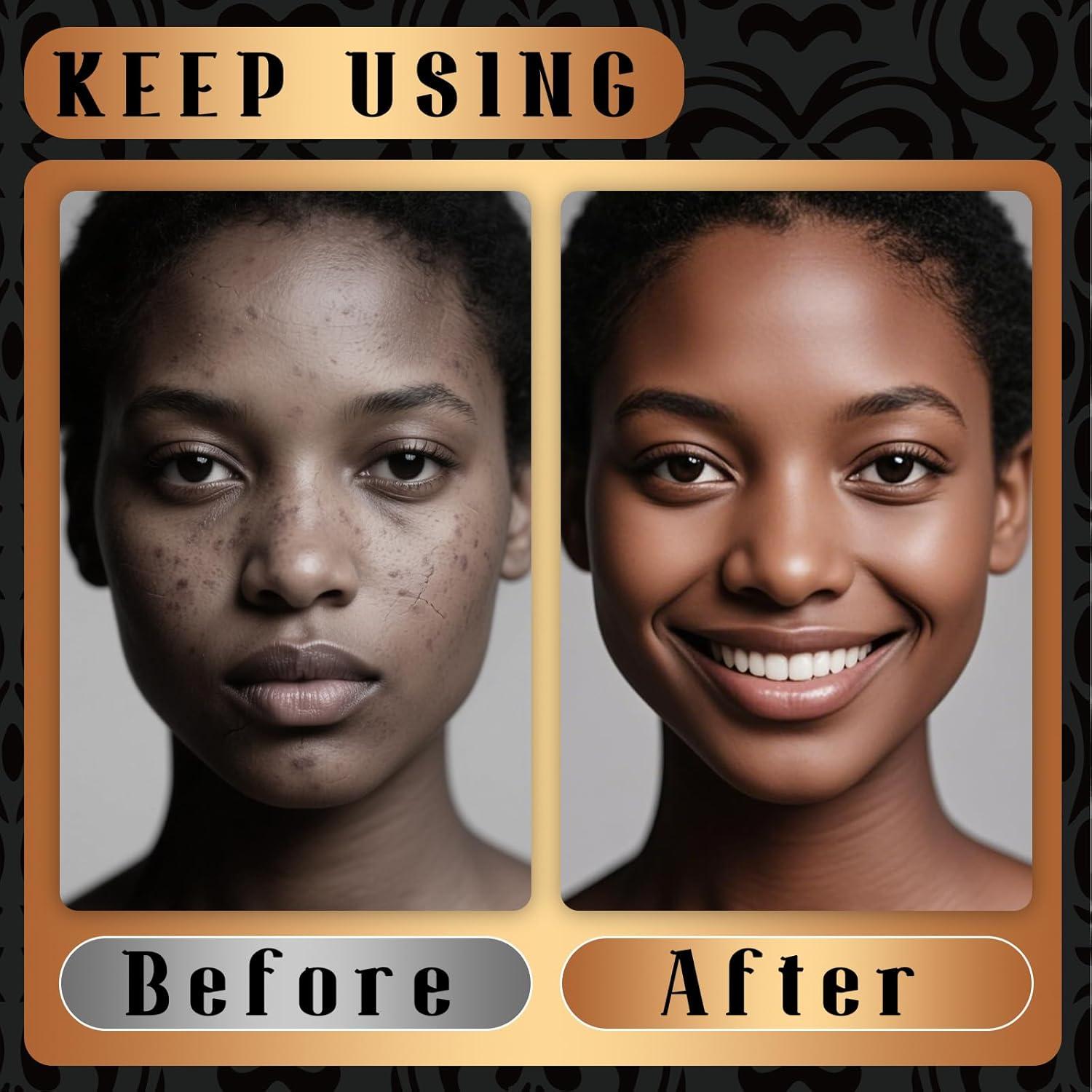 Esponjas de Red Africana Baypearl - 2 Piezas Exfoliantes