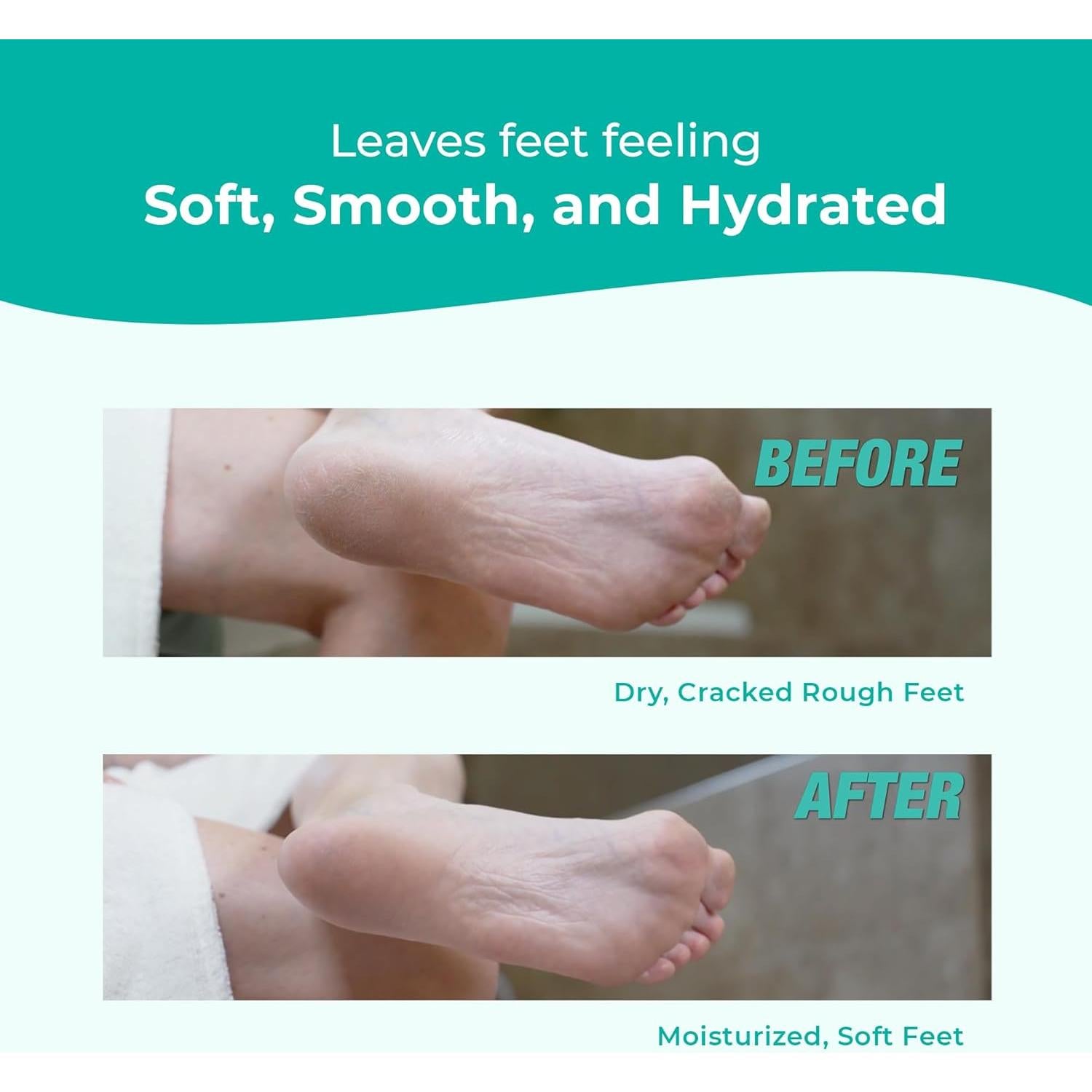 Crema para Pies Richenna EZ - Exfoliante y Hidratante 100ml