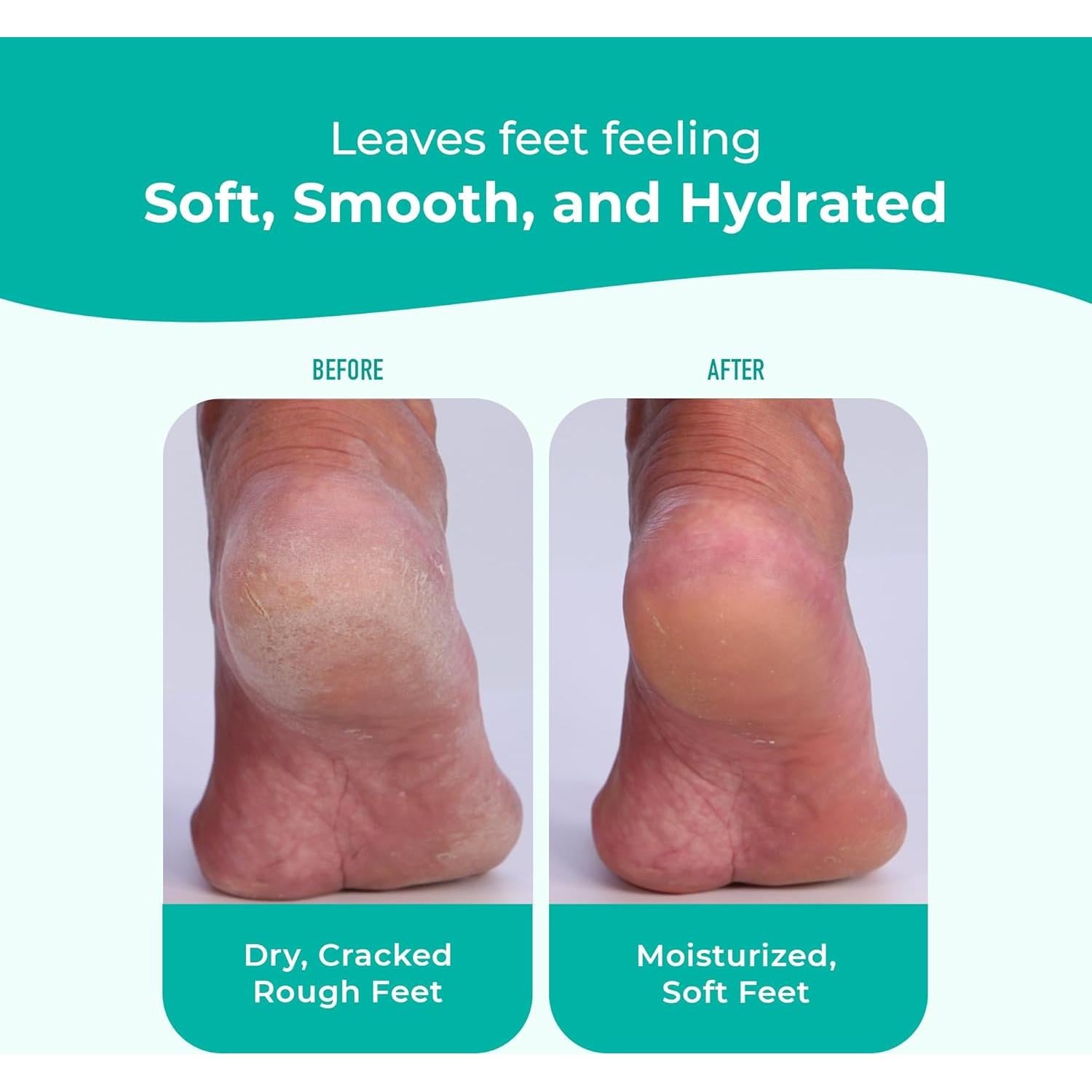 Crema para Pies Richenna EZ - Exfoliante y Hidratante 100ml