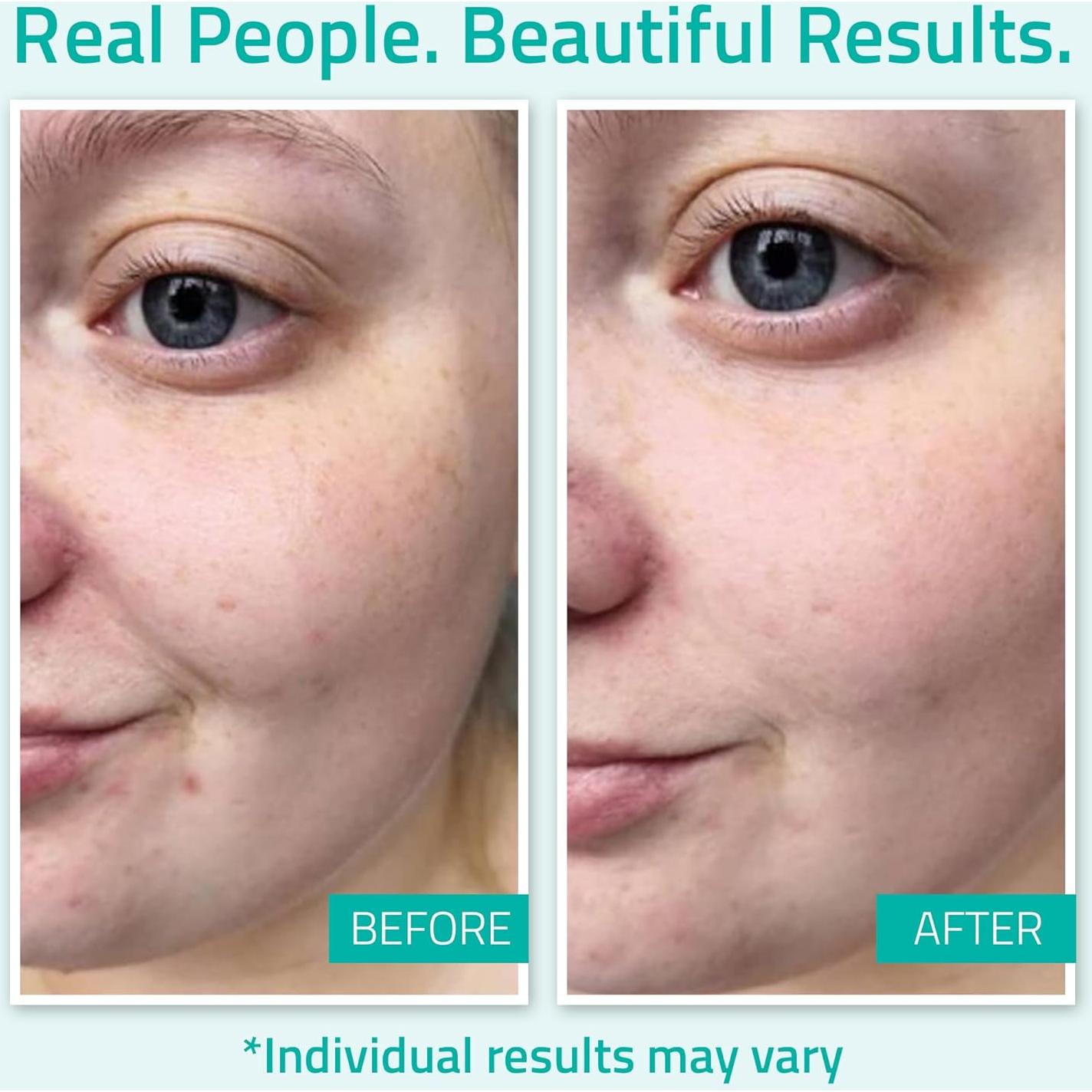 Suero Hidratante de Ácido Hialurónico YEOUTH 30ml Piel Seca