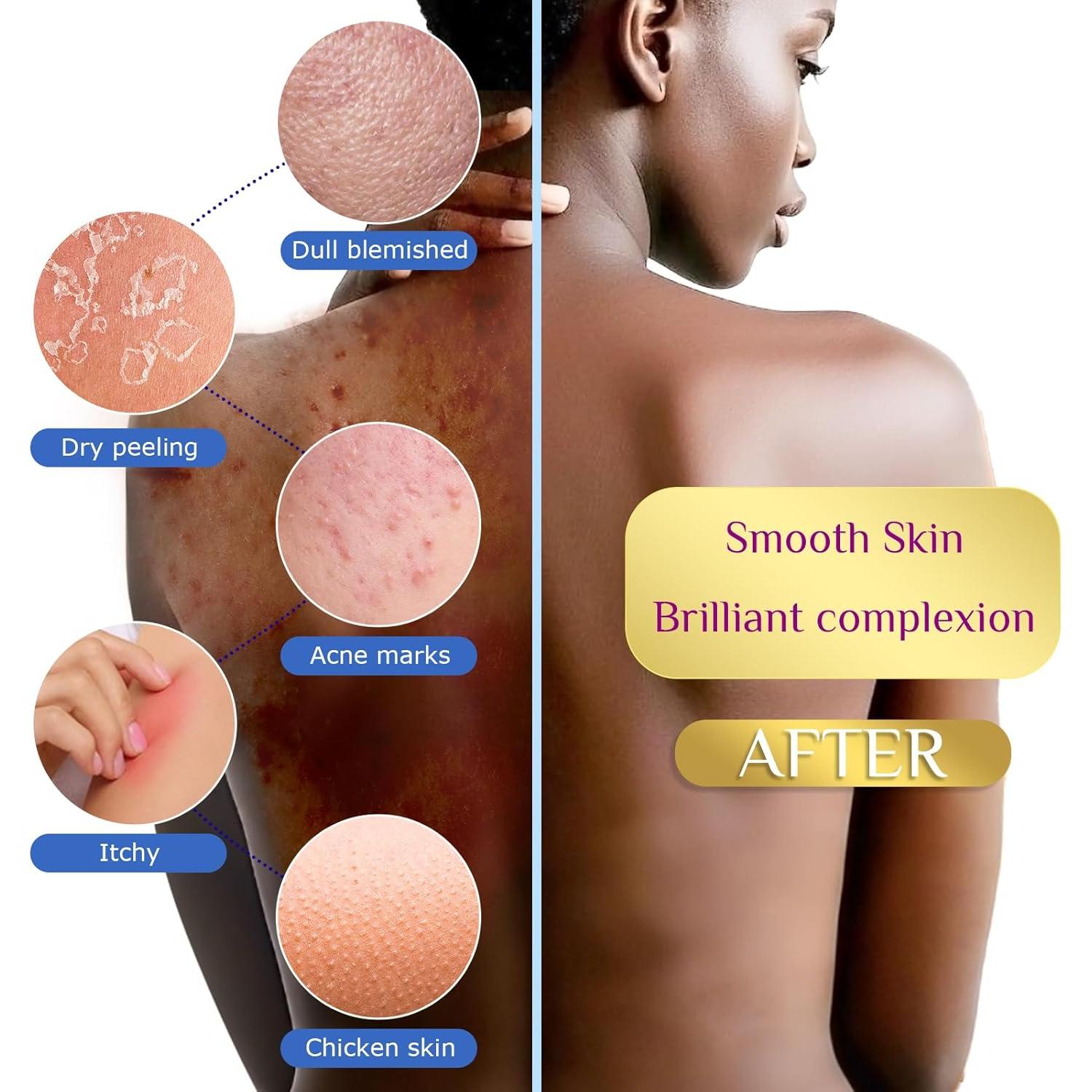 Esponja de Red Africana ACLMFUP - 4 Piezas Exfoliantes 30x80 cm