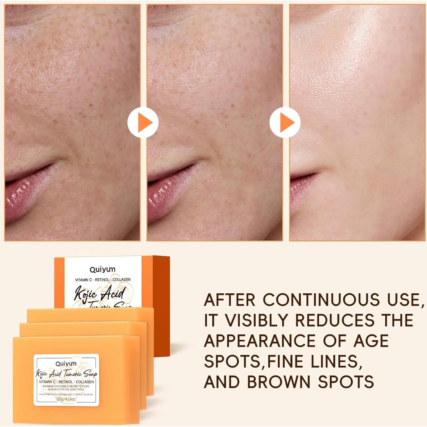 Jabón de Ácido Kójico y Cúrcuma QUIYUM - 3 Unidades + Esponja