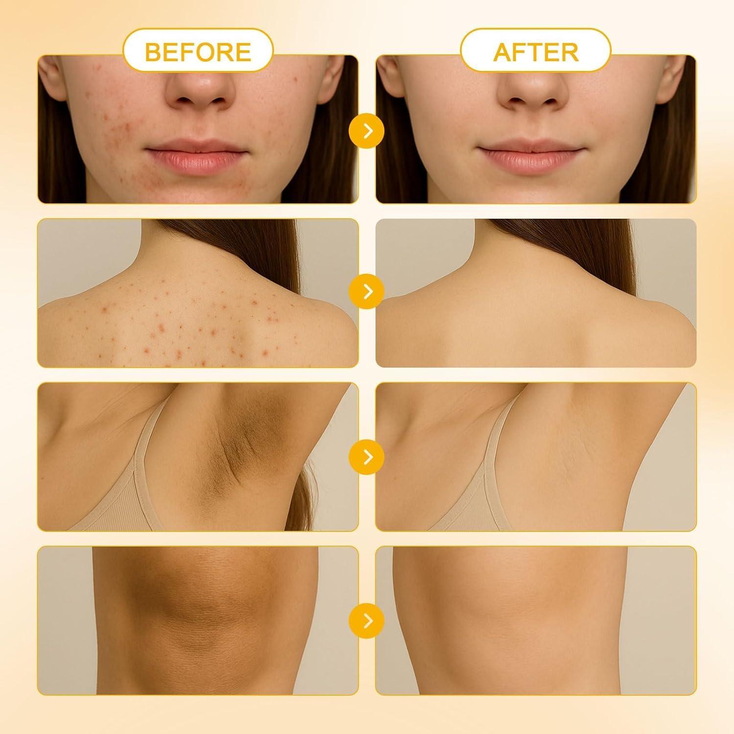 Jabón de Cúrcuma Zotreval + Esponja Exfoliante Africana