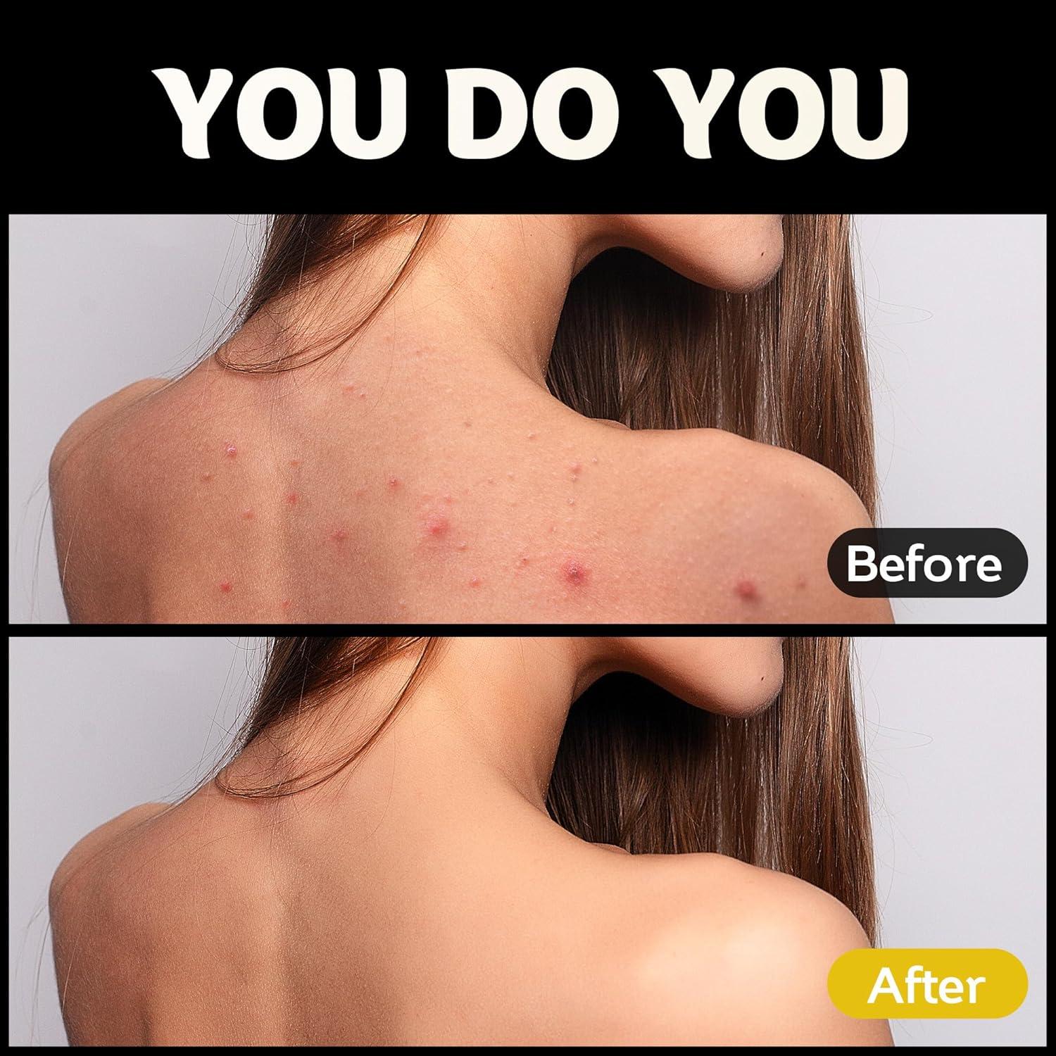 Esponjas de Red Africana ACLMFUP - 2 Piezas Exfoliantes