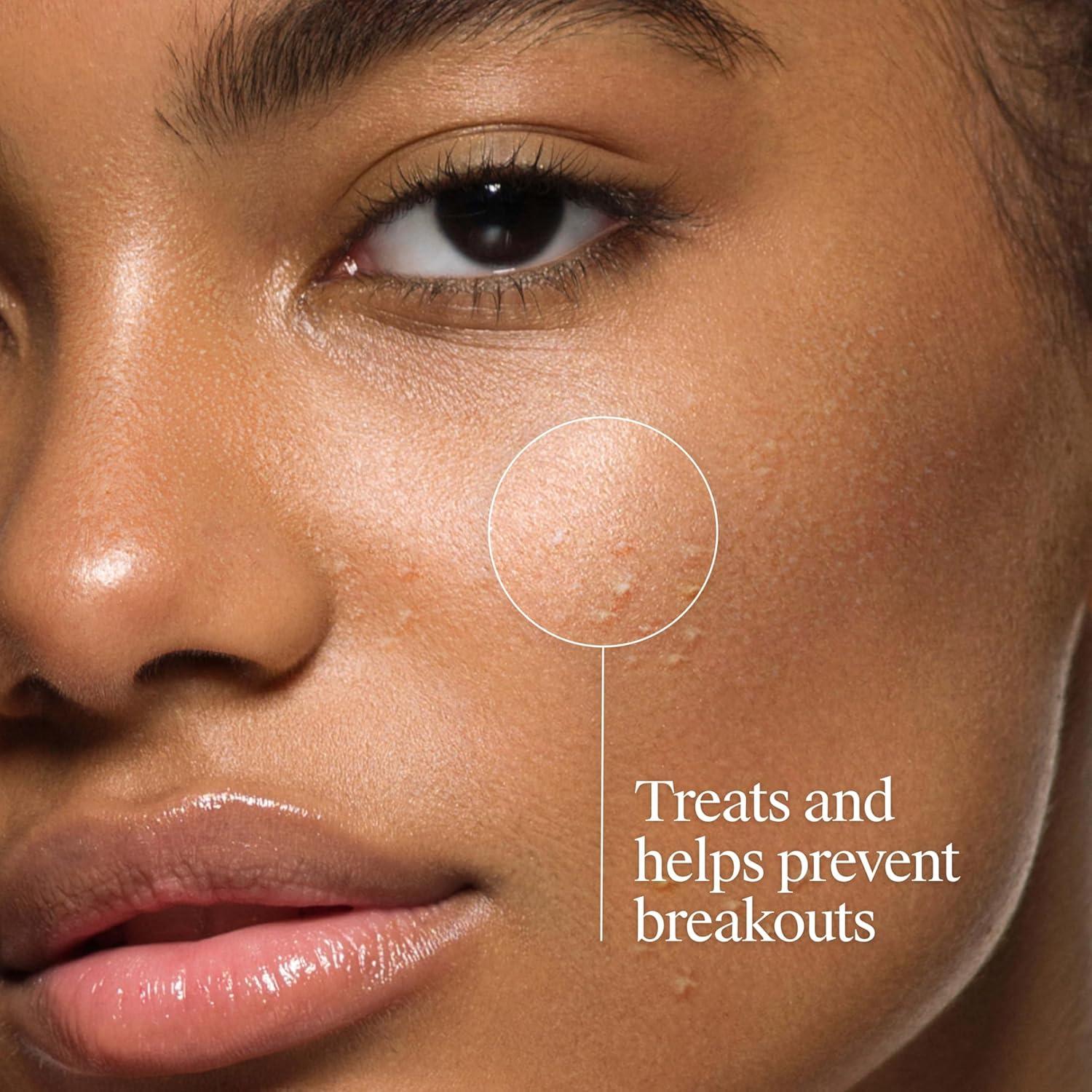 Limpiador Facial Sin Aceite Neutrogena 269 ml - Acné 2% Ácido Salicílico