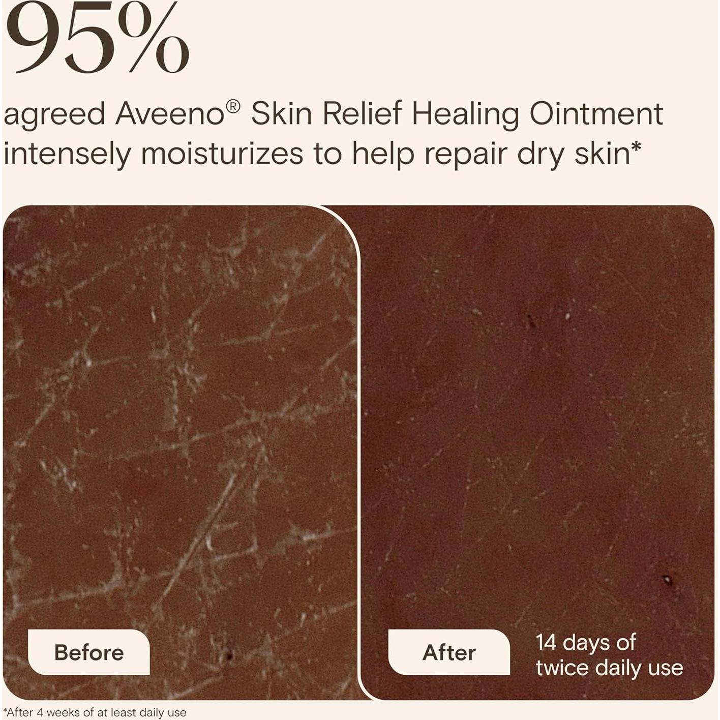 Pomada Curativa Aveeno Skin Relief 204 g - Triple Avena y Karité