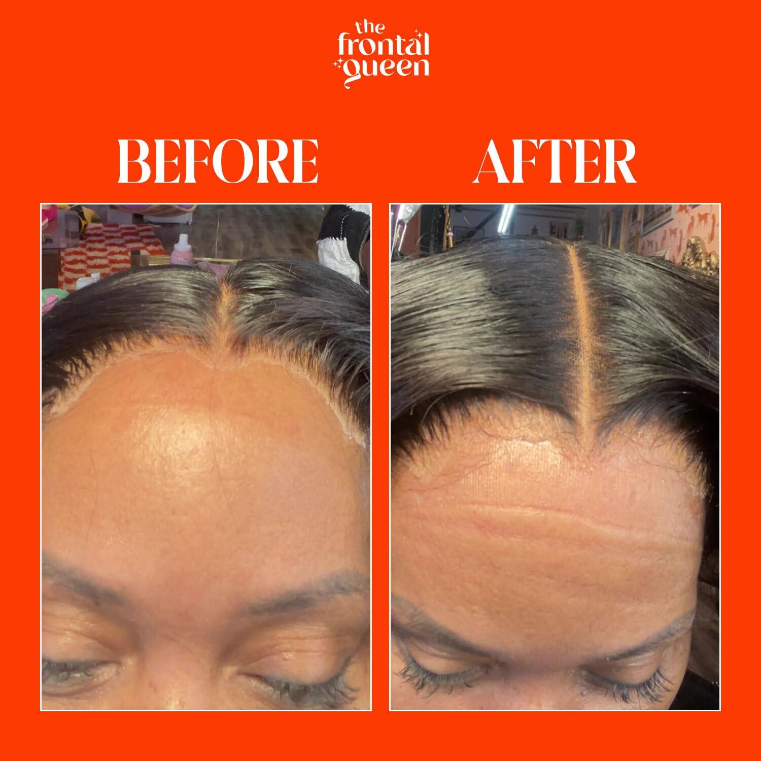 Spray Derretidor de Encaje The Frontal Queen 119 g - Fijación Fuerte