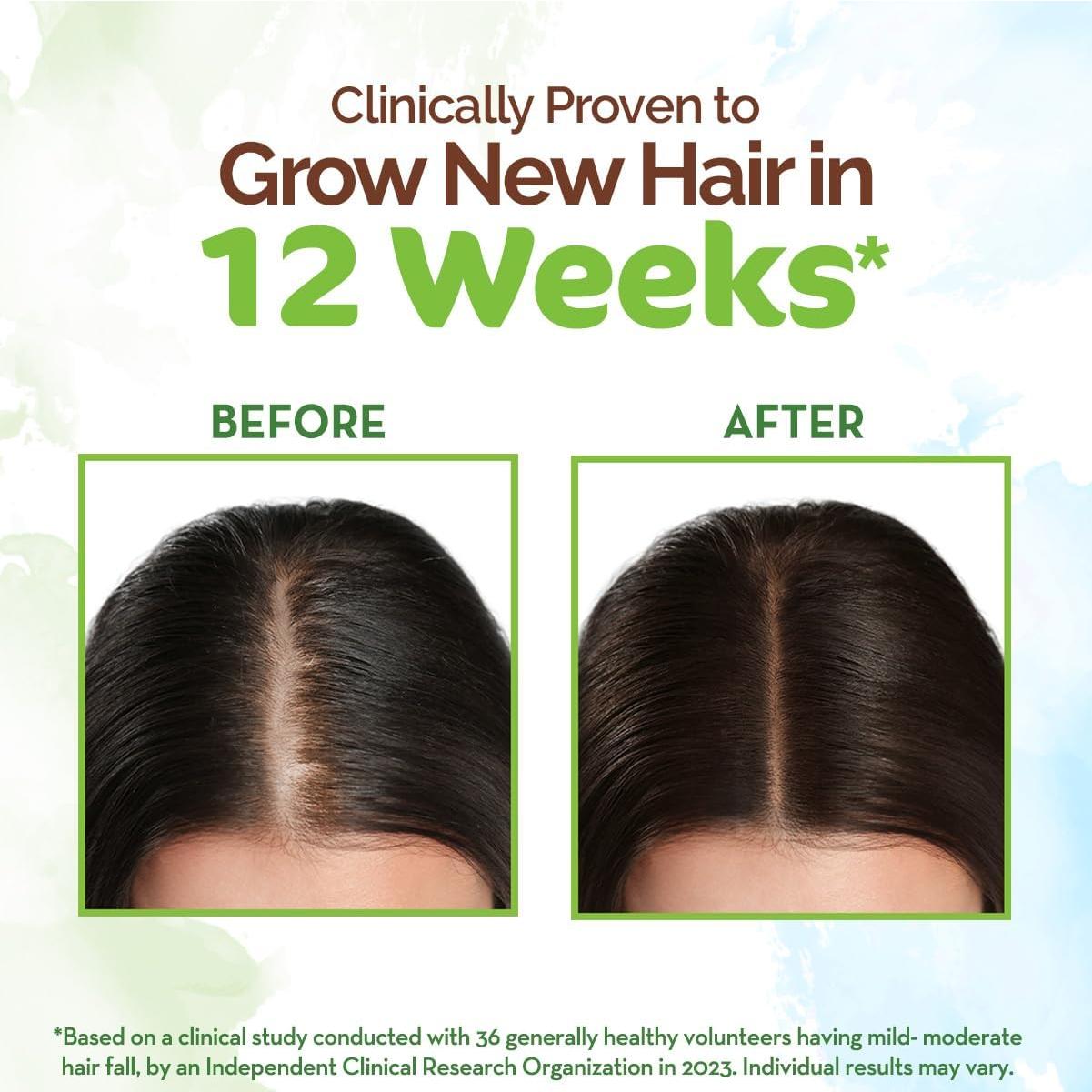 Aceite de Crecimiento Capilar Mamaearth 200 ml - Romero y Fenogreco