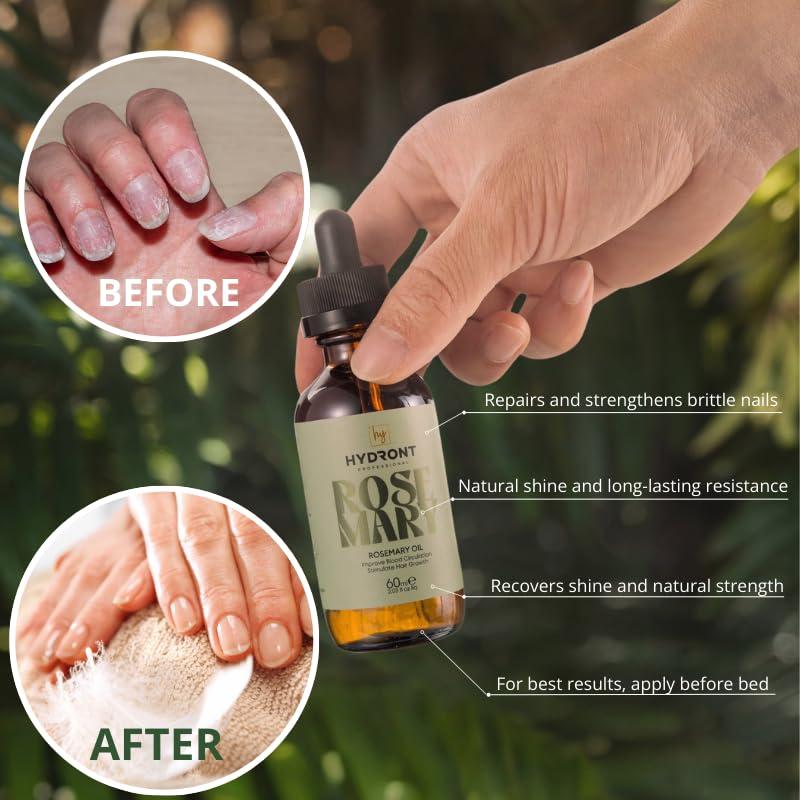 Suero Capilar Natural Hydront Romero 60ml - Crecimiento y Brillo