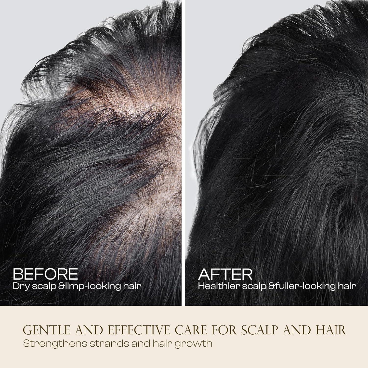 Aceite Crecimiento Cabello Jtopyrt 50ml Romero y Ricino