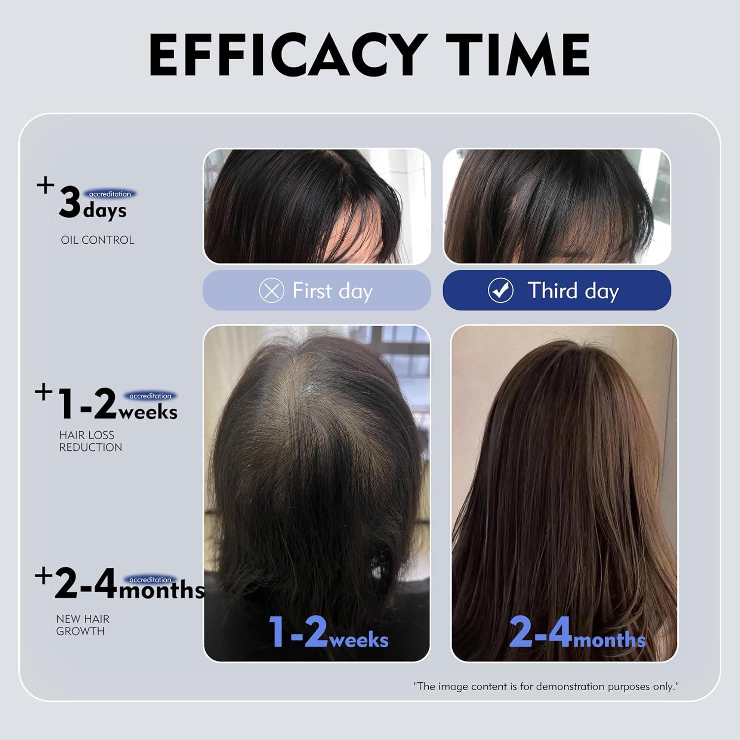 Spray Kintor 60ml Pro 0.9% Bloqueador DHT Crecimiento Cabello