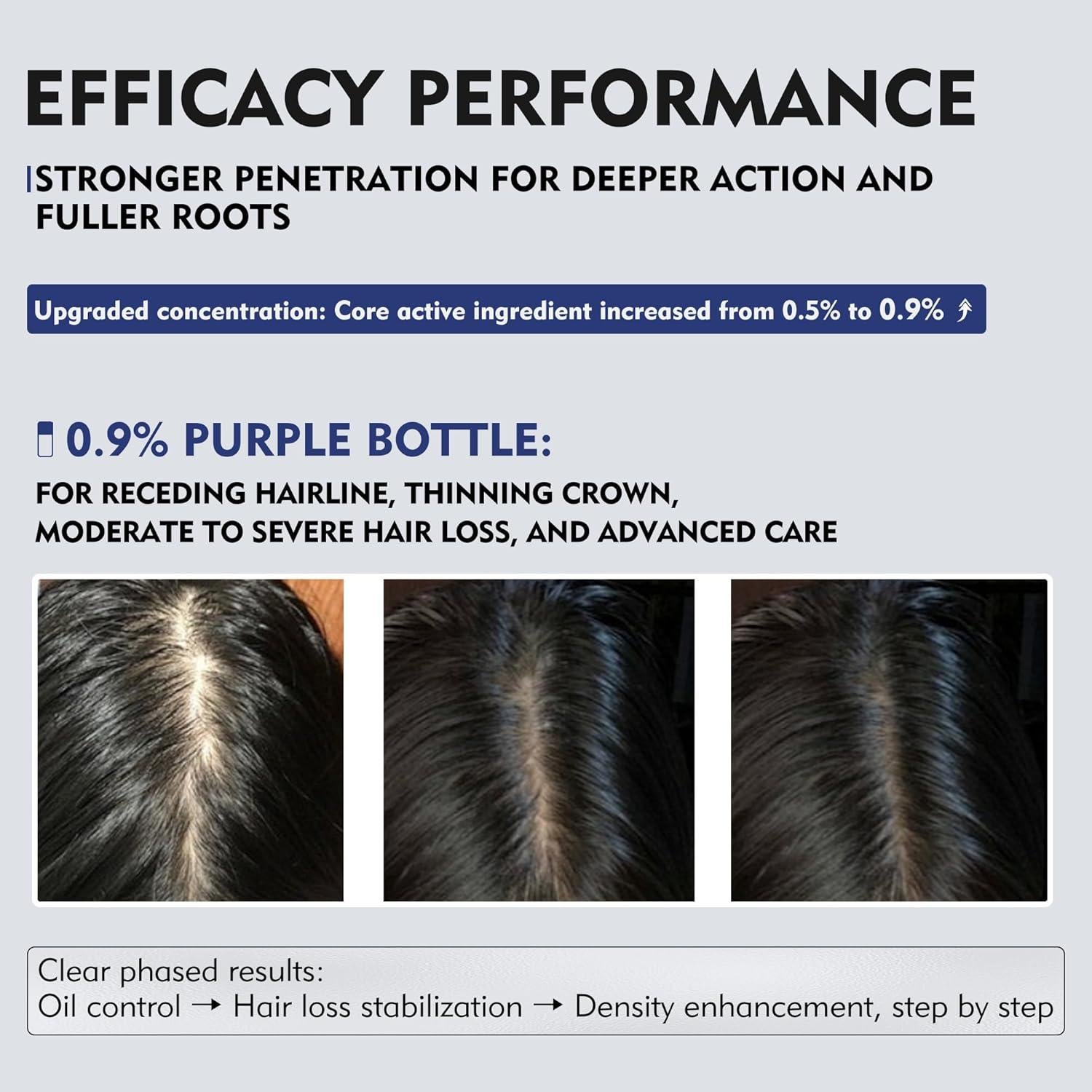 Spray Kintor 60ml Pro 0.9% Bloqueador DHT Crecimiento Cabello