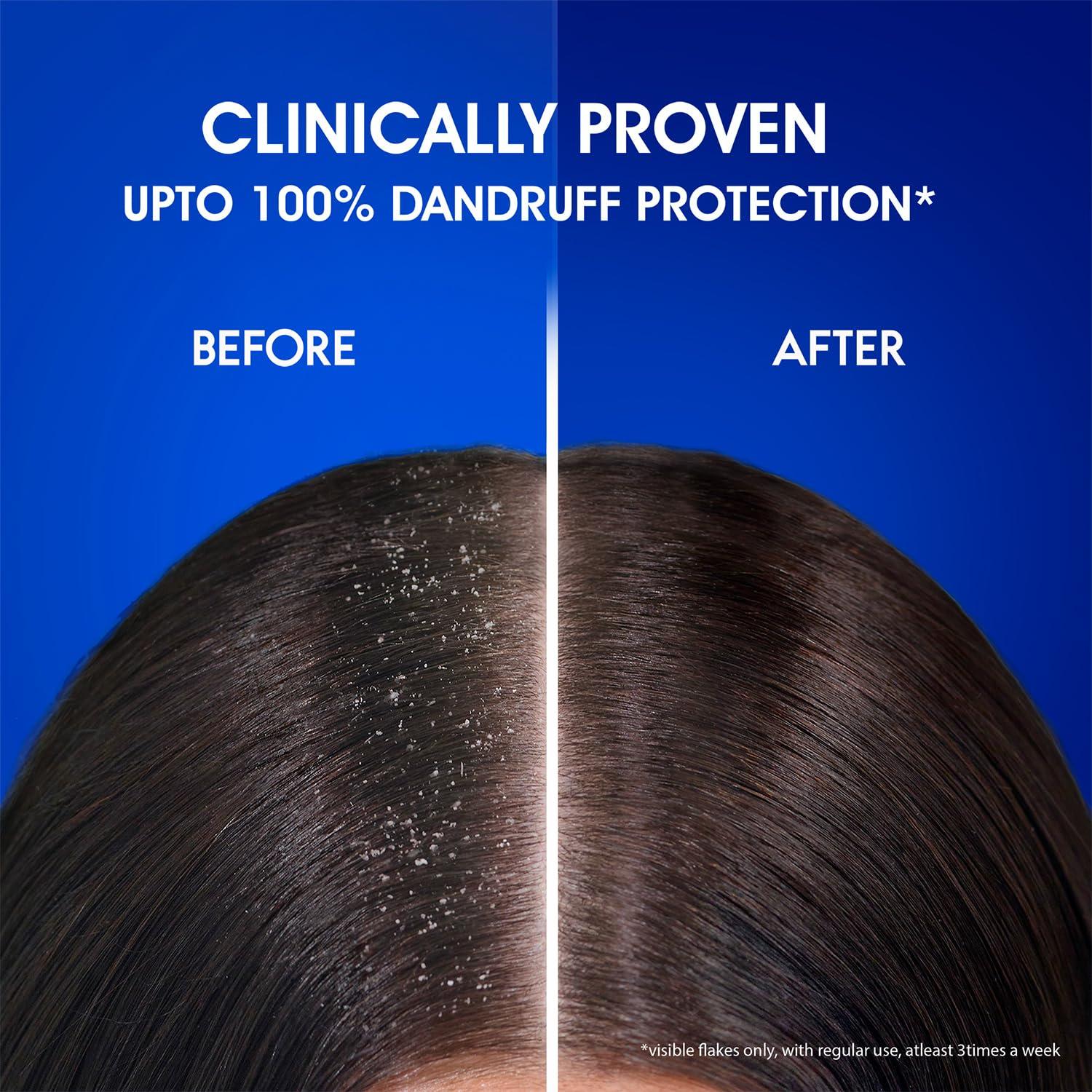 Champú Anticaspa Head & Shoulders Mentol Fresco 340ml