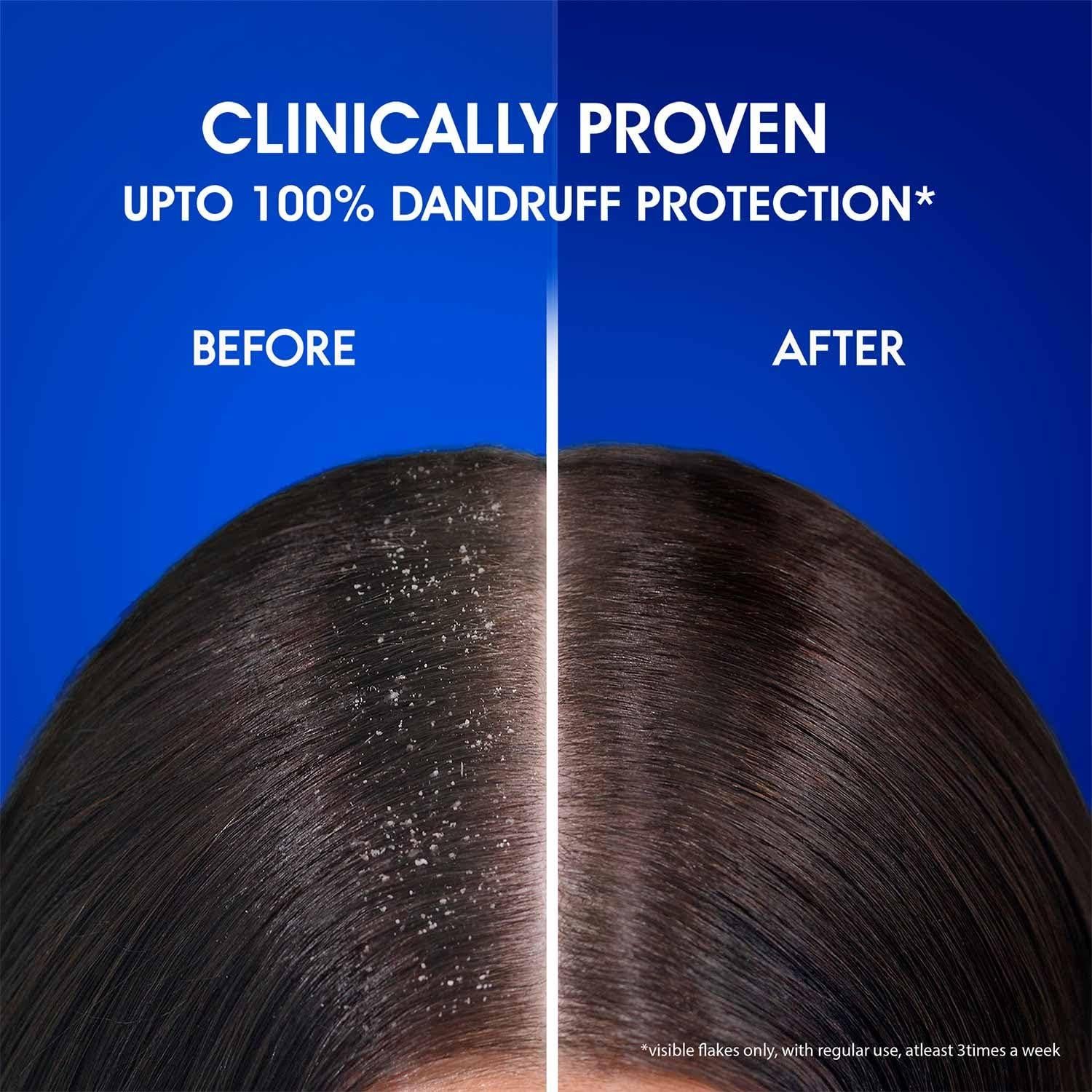 Champú Anticaspa Head & Shoulders Mentol Fresco 340ml