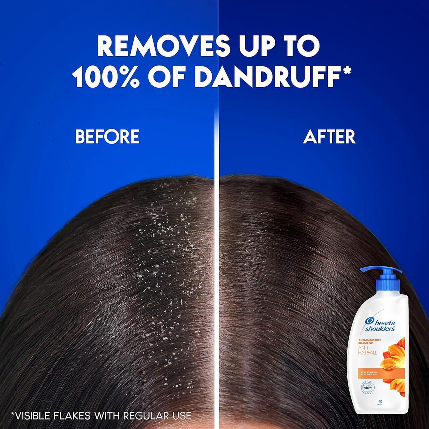 Champú Anticaspa Head & Shoulders 2x22 oz, Alivia Cuero Cabelludo