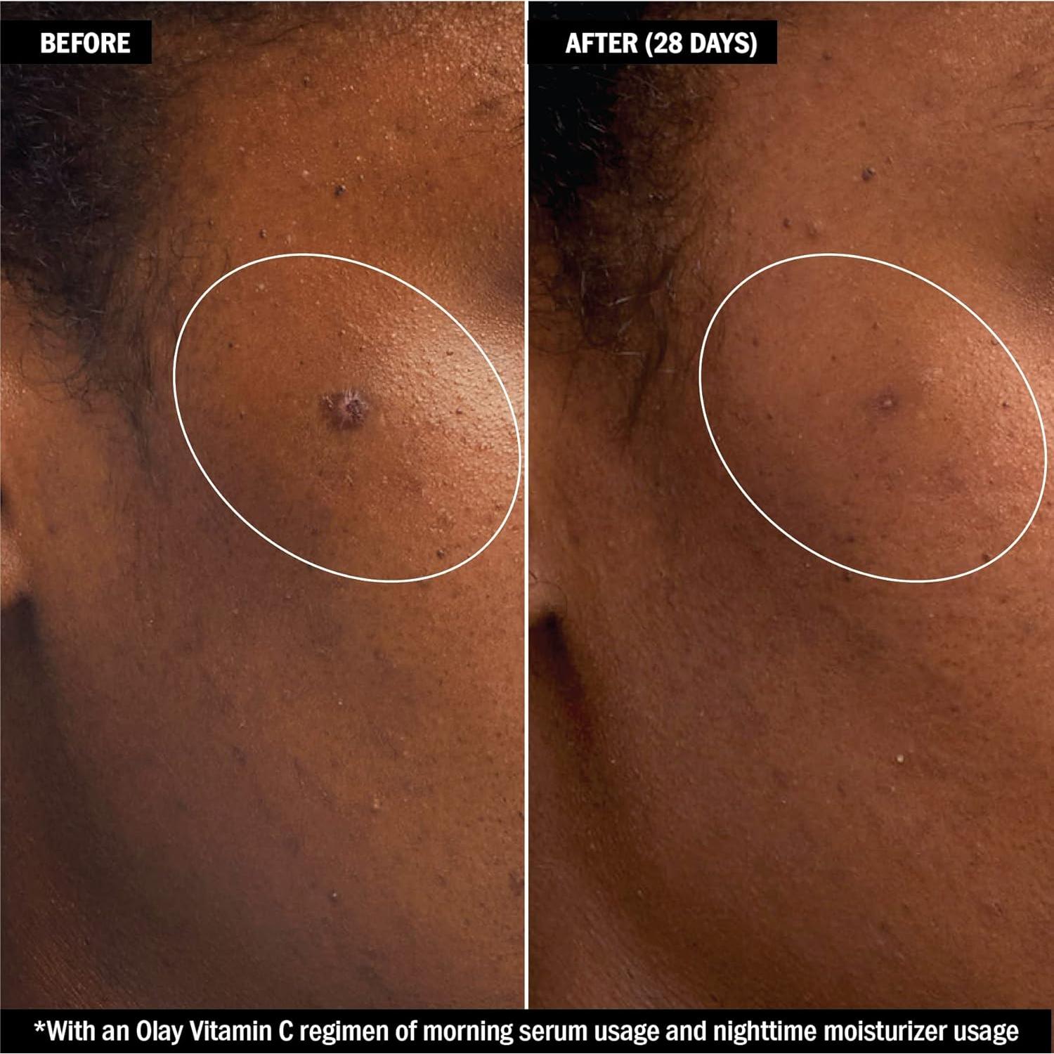 Olay Regenerist Crema Hidratante Facial Vitamina C y Retinol 48g