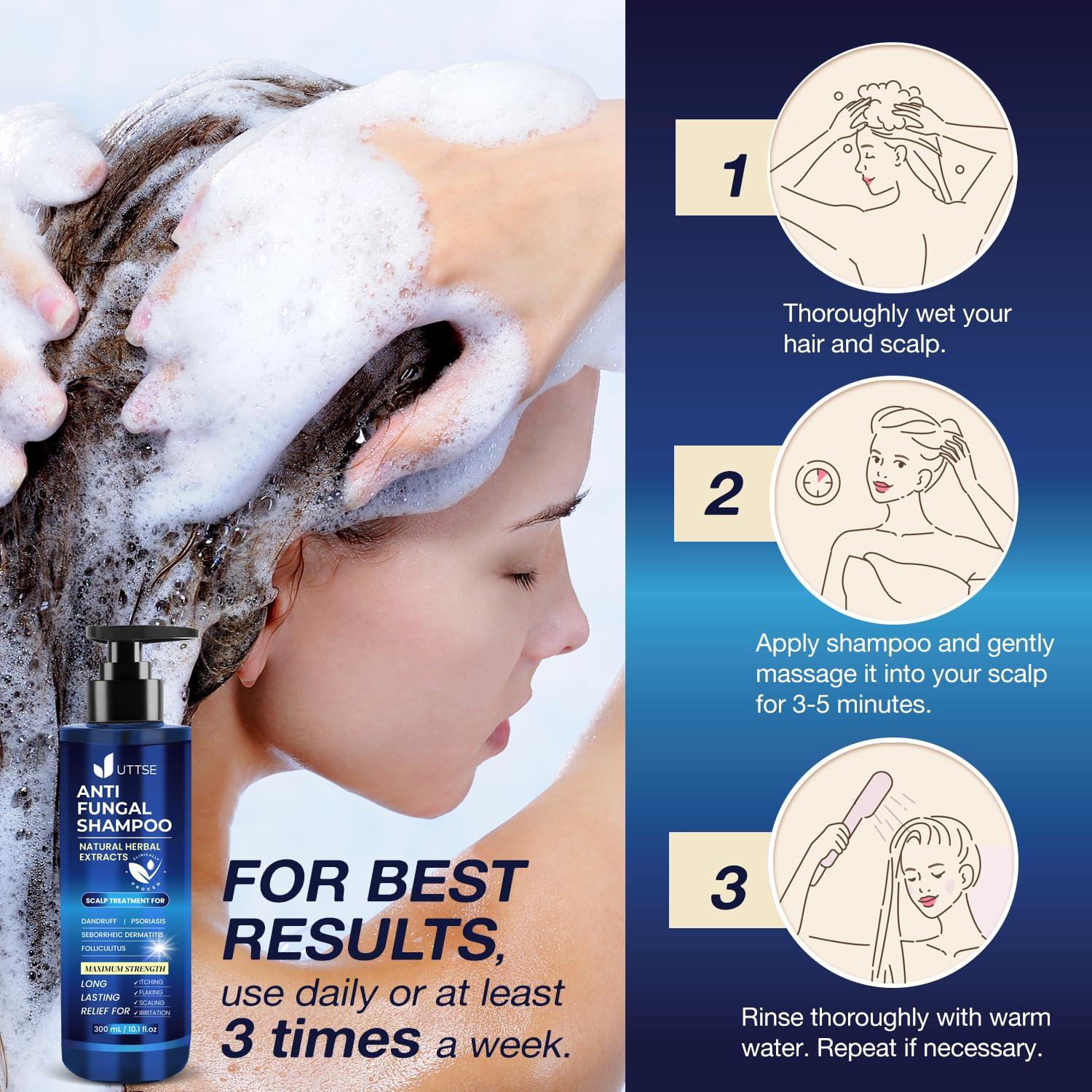 Champú Antifúngico UTTSE 300 mL para Psoriasis y Caspa