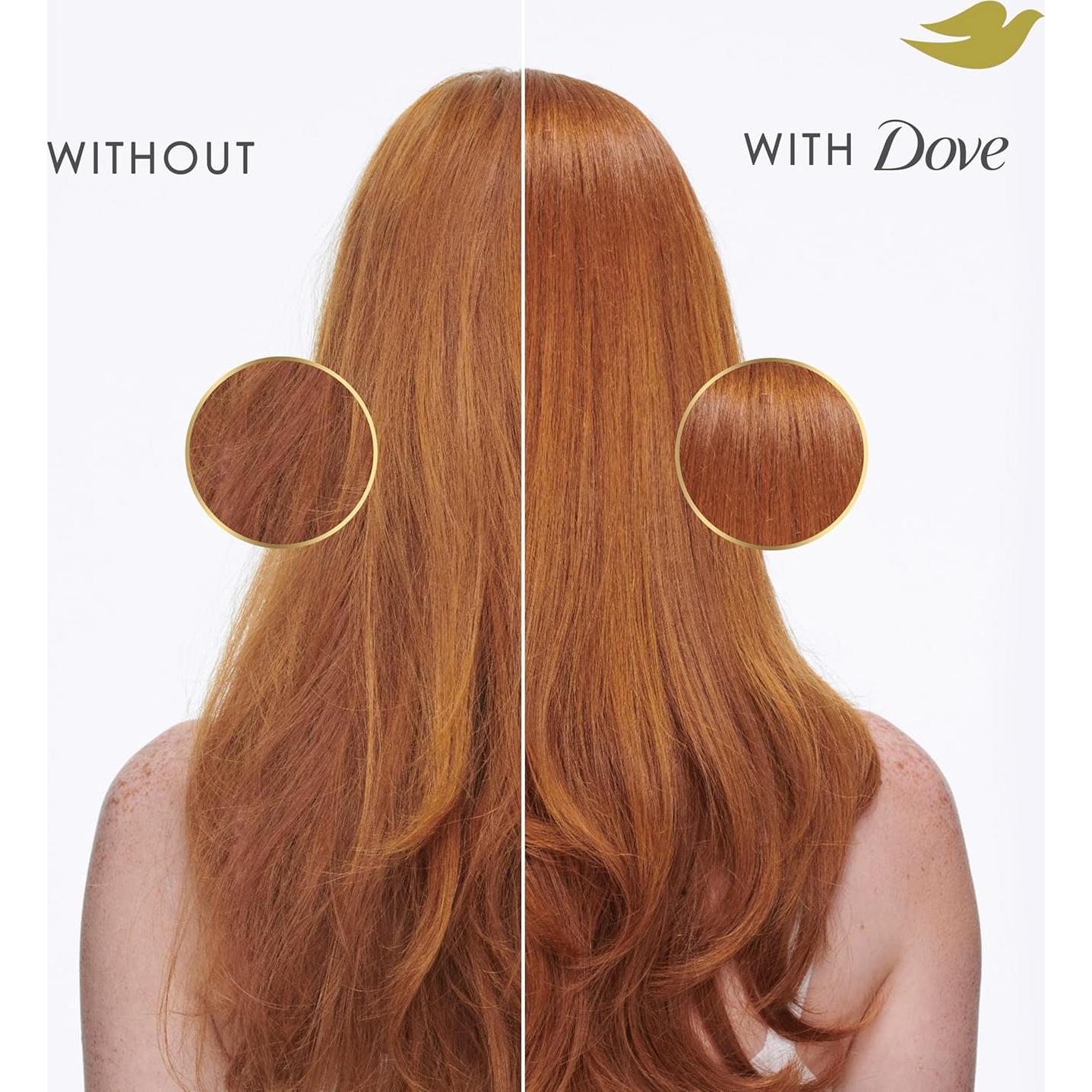 Champú Dove Reparación Intensiva 828 ml para Cabello Dañado