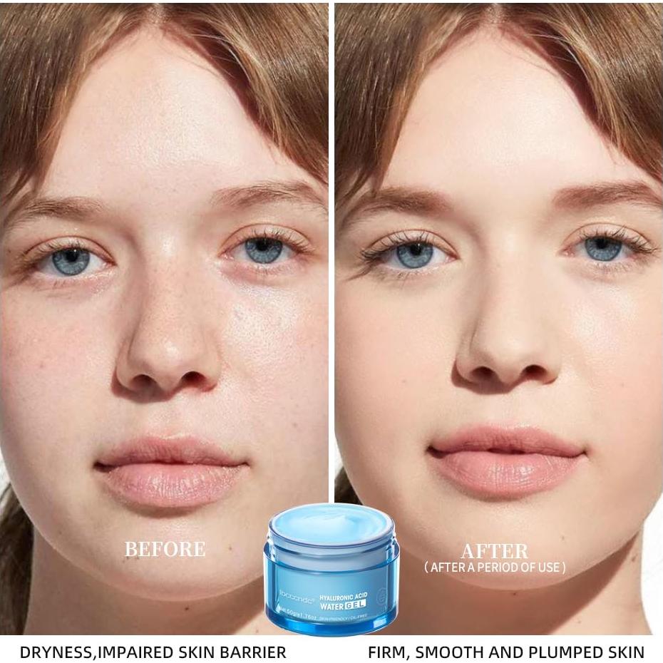 Gel Hidratante Facial Ácido Hialurónico Hydro Boost 134g