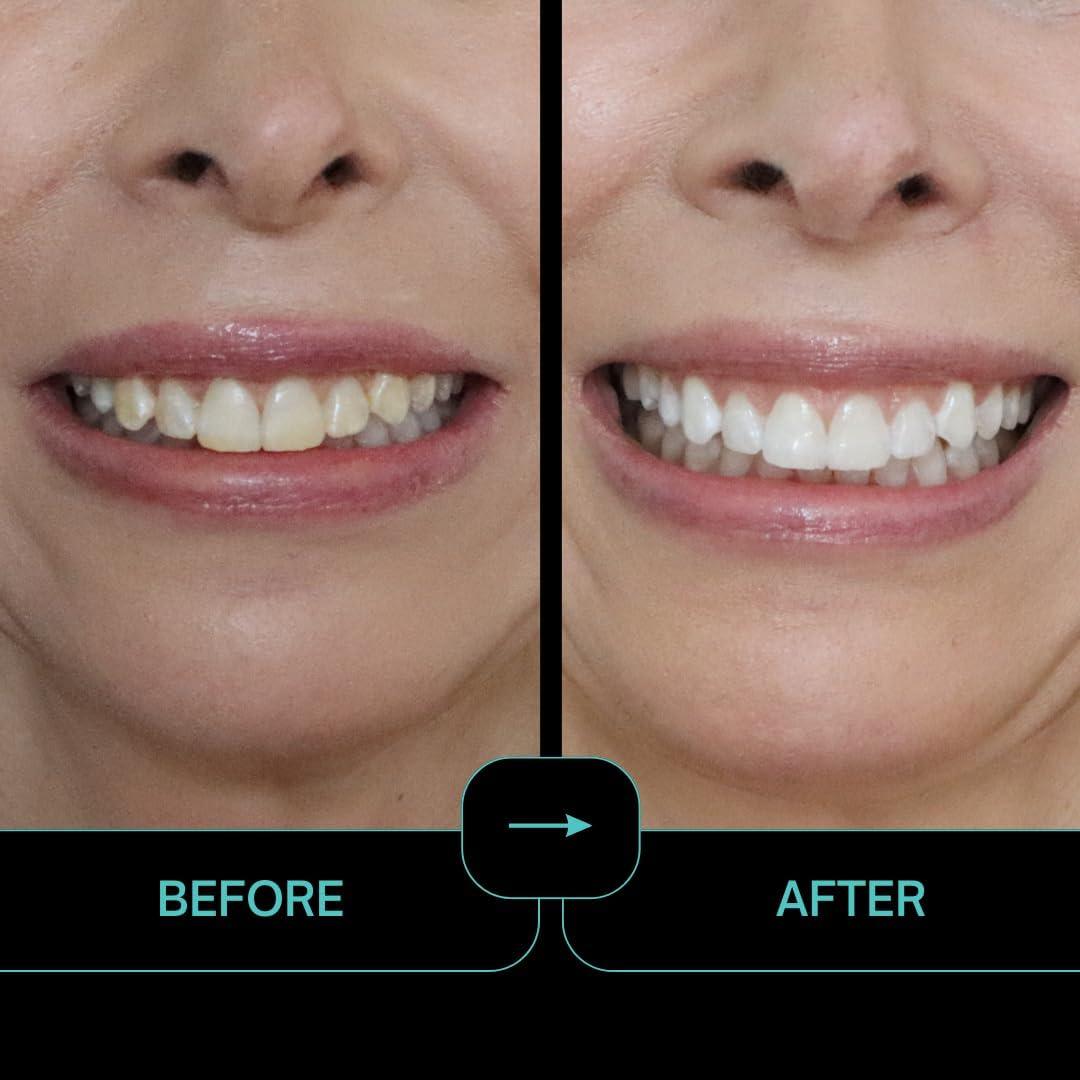 Prostrips - 12 Tonos Más Blancos - 56 Tiras Remineralizantes