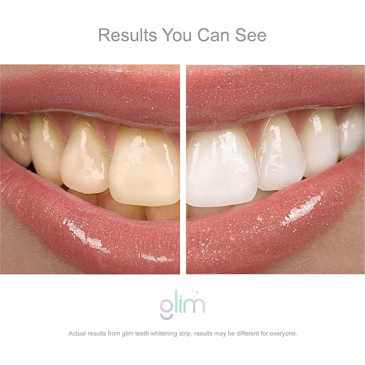 Tiras Blanqueadoras de Dientes Glim - 42 Tiras (21 Tratamientos) Veganas