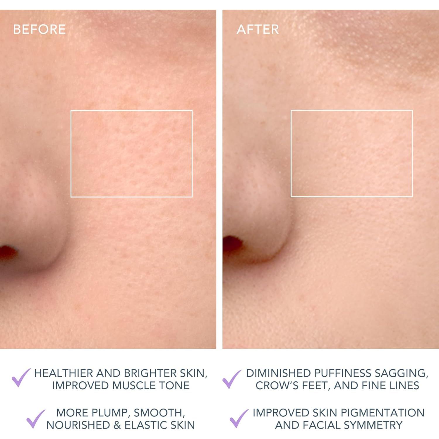 Cepillo Limpiador Facial Foreo LUNA 4 - Masajeador Reafirmante