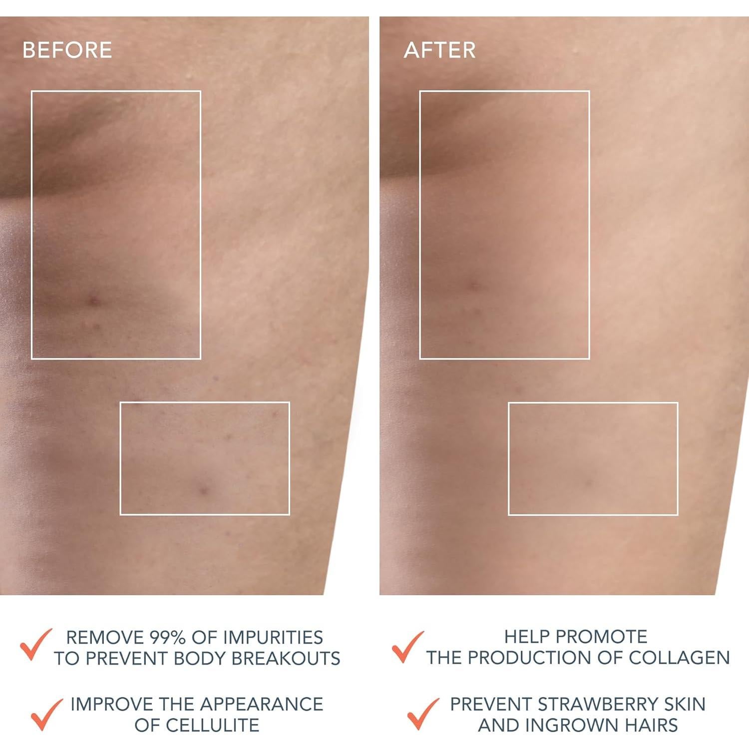 Cepillo Corporal Foreo LUNA 4 - Exfoliante T-Sonic Durazno