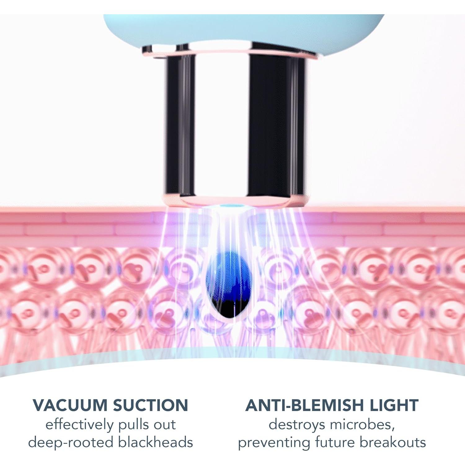 Extractor de Puntos Negros KIWI Foreo + Limpiador LUNA 2.0