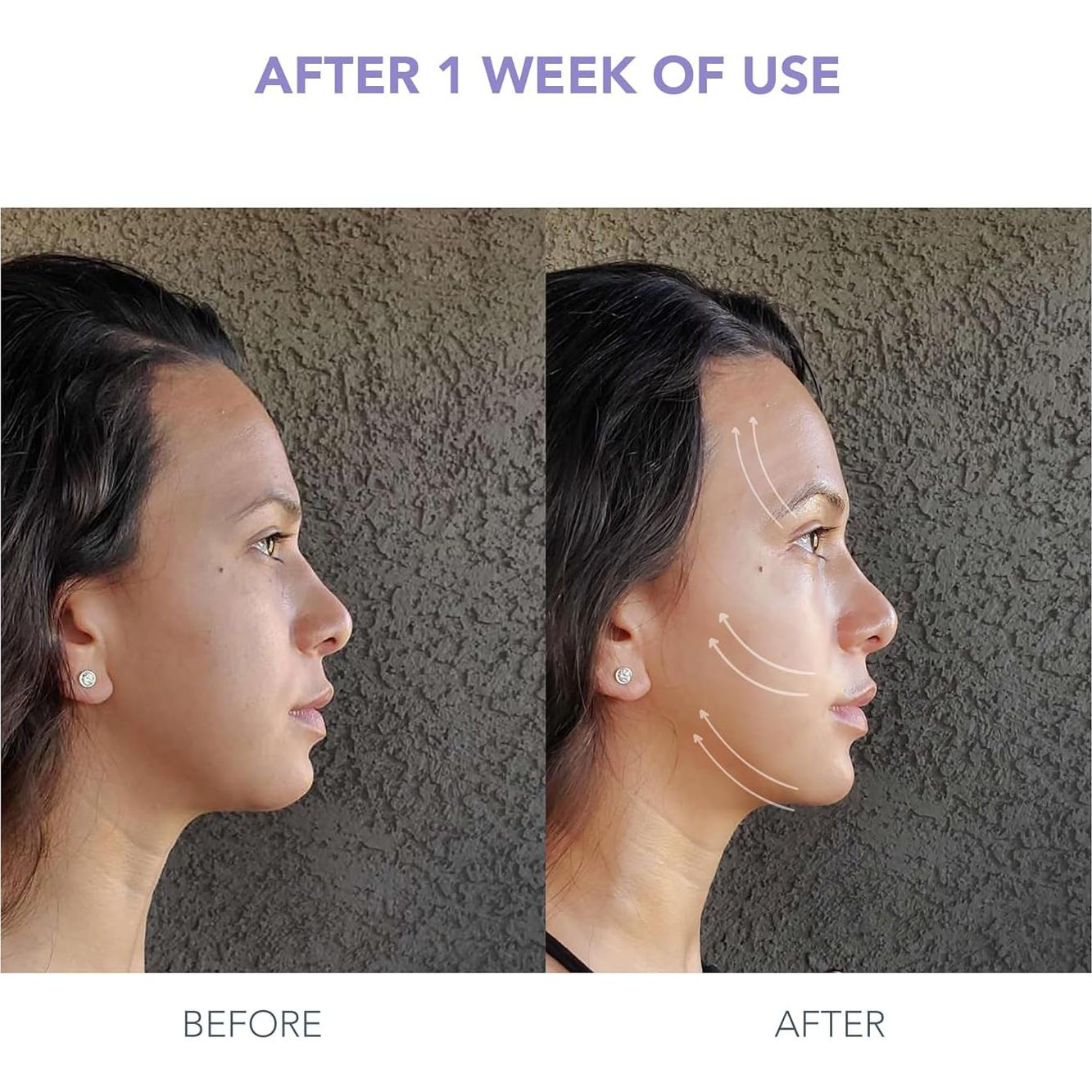 Dispositivo Facial Microcorriente FOREO BEAR Mini + Suero 30ml