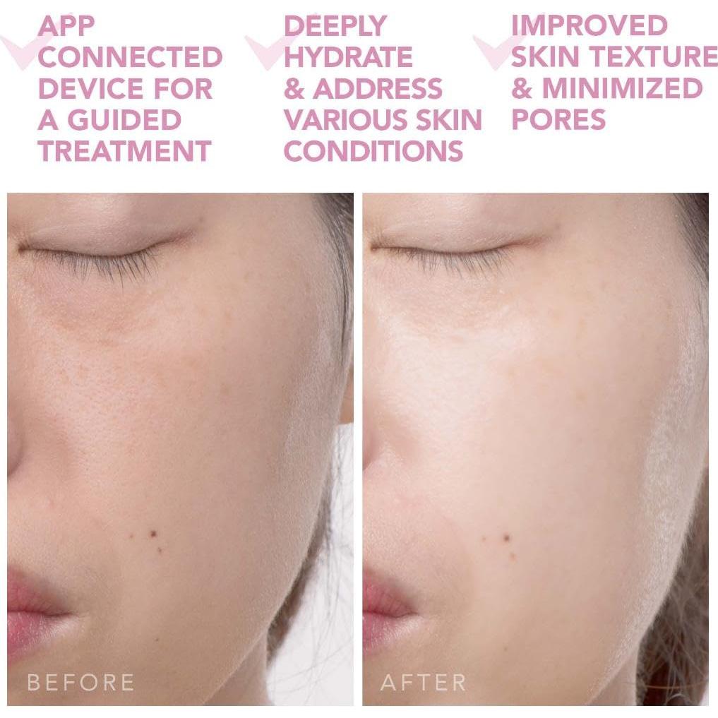 FOREO UFO 2 Máscara Facial Calentamiento Hidratante Rosa Perla