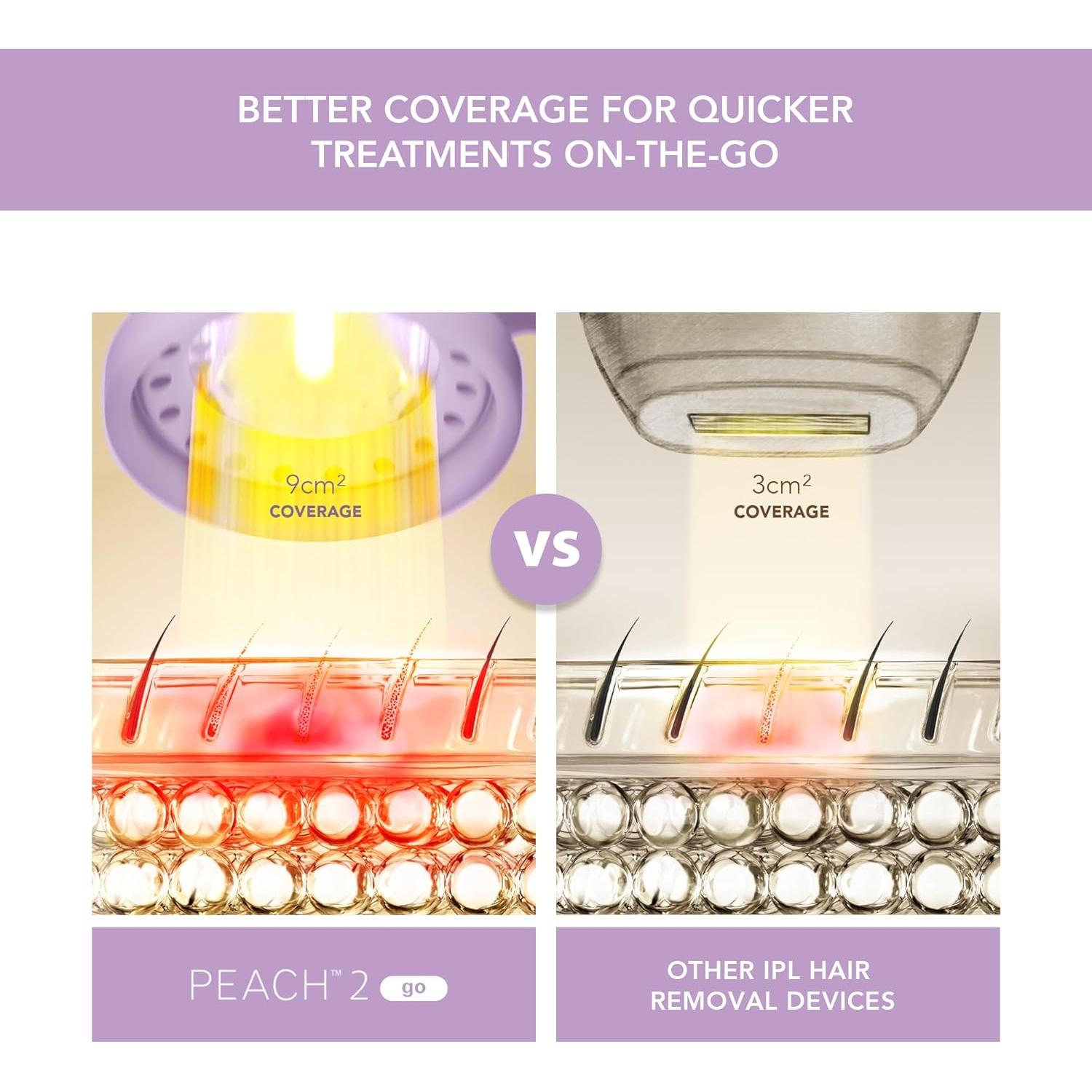 Epilador IPL FOREO DURAZNO 2 en Movimiento - Lavanda