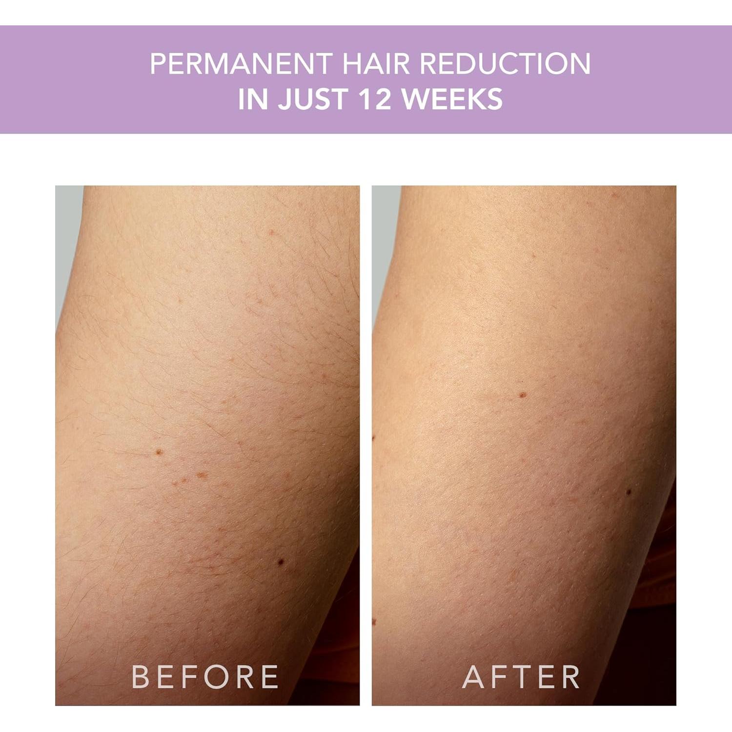 Epilador IPL FOREO DURAZNO 2 en Movimiento - Lavanda