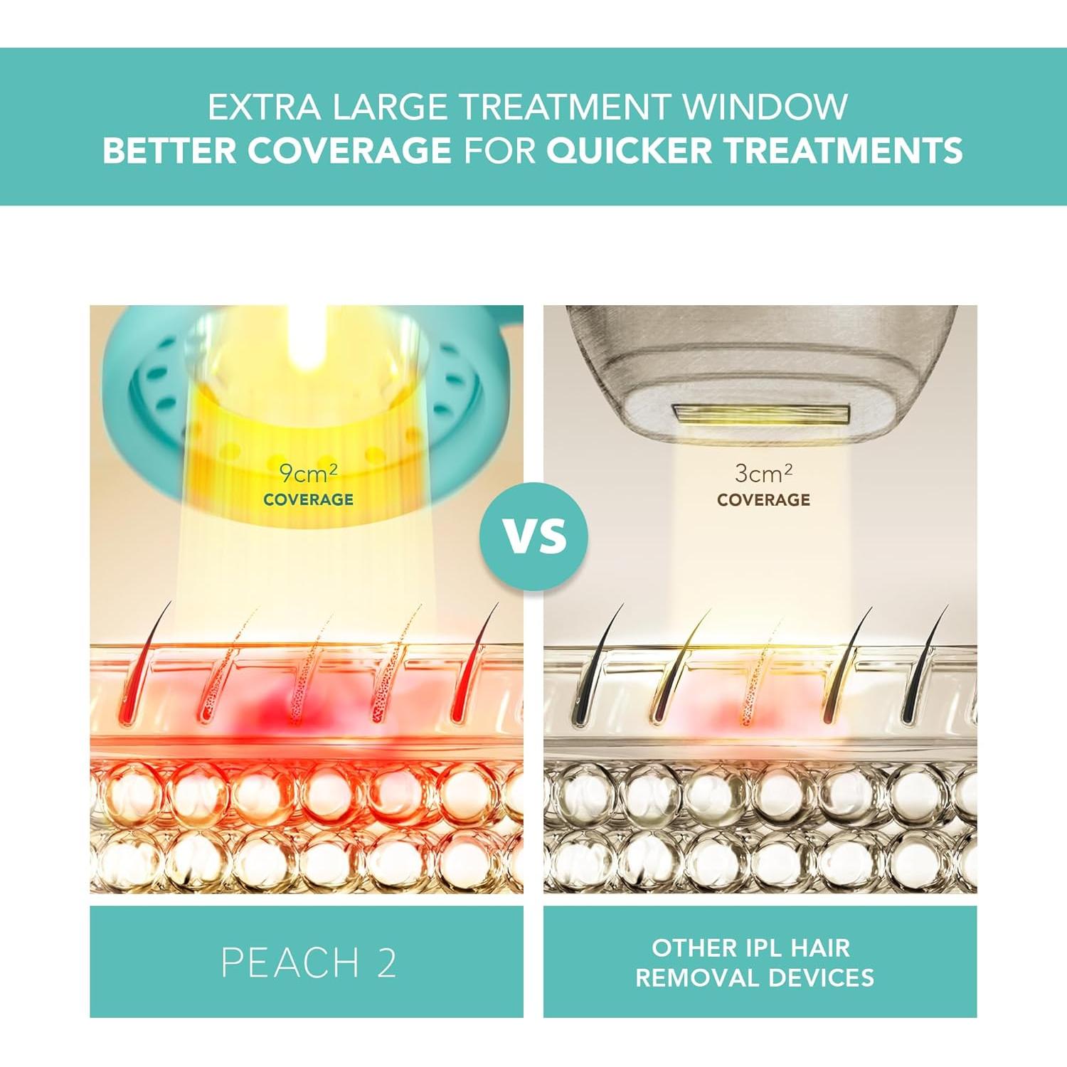 Dispositivo IPL de Remoción de Vello FOREO PEACH 2 - Azul