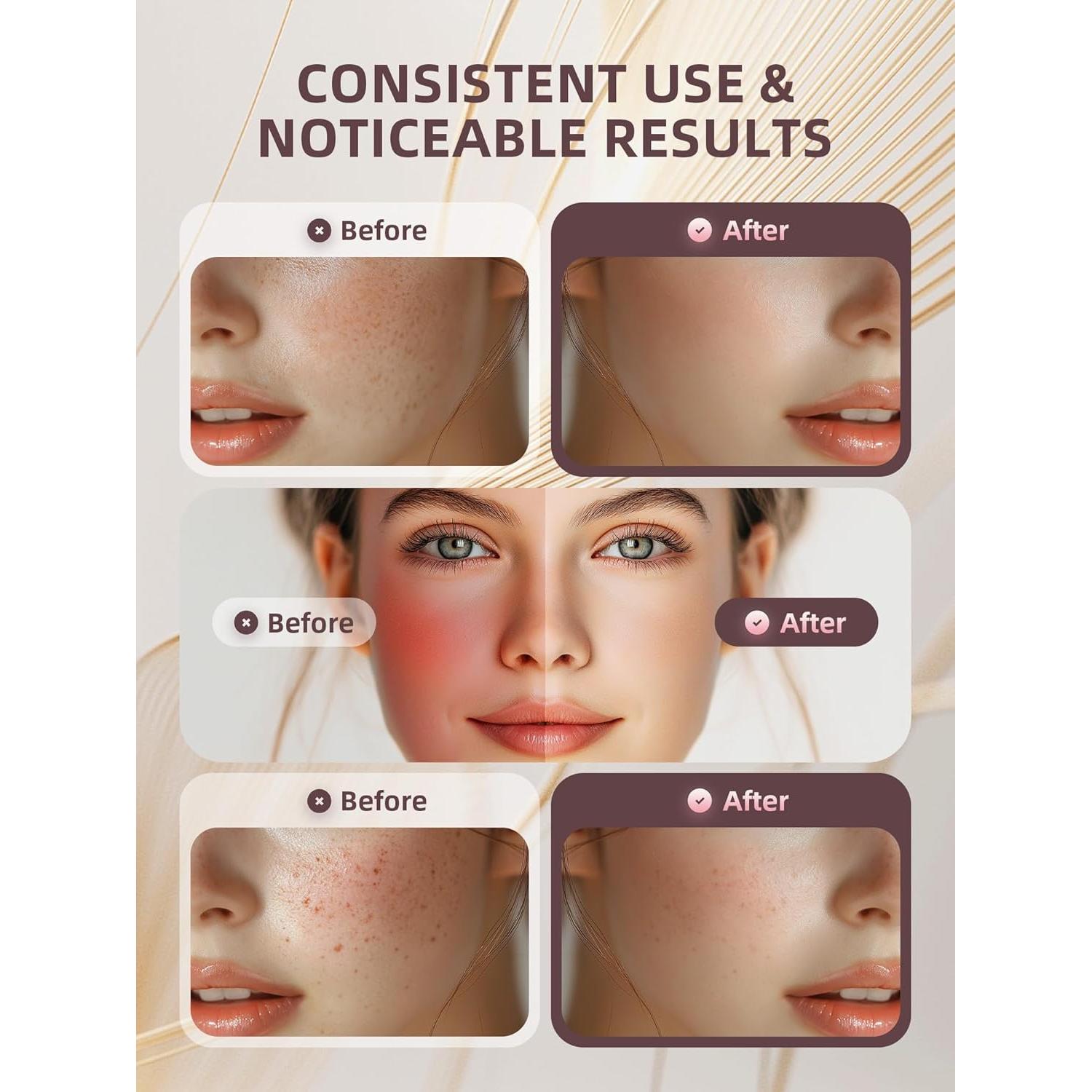 Masajeador Facial INTEO 2328 - Dispositivo de Belleza 3 Modos