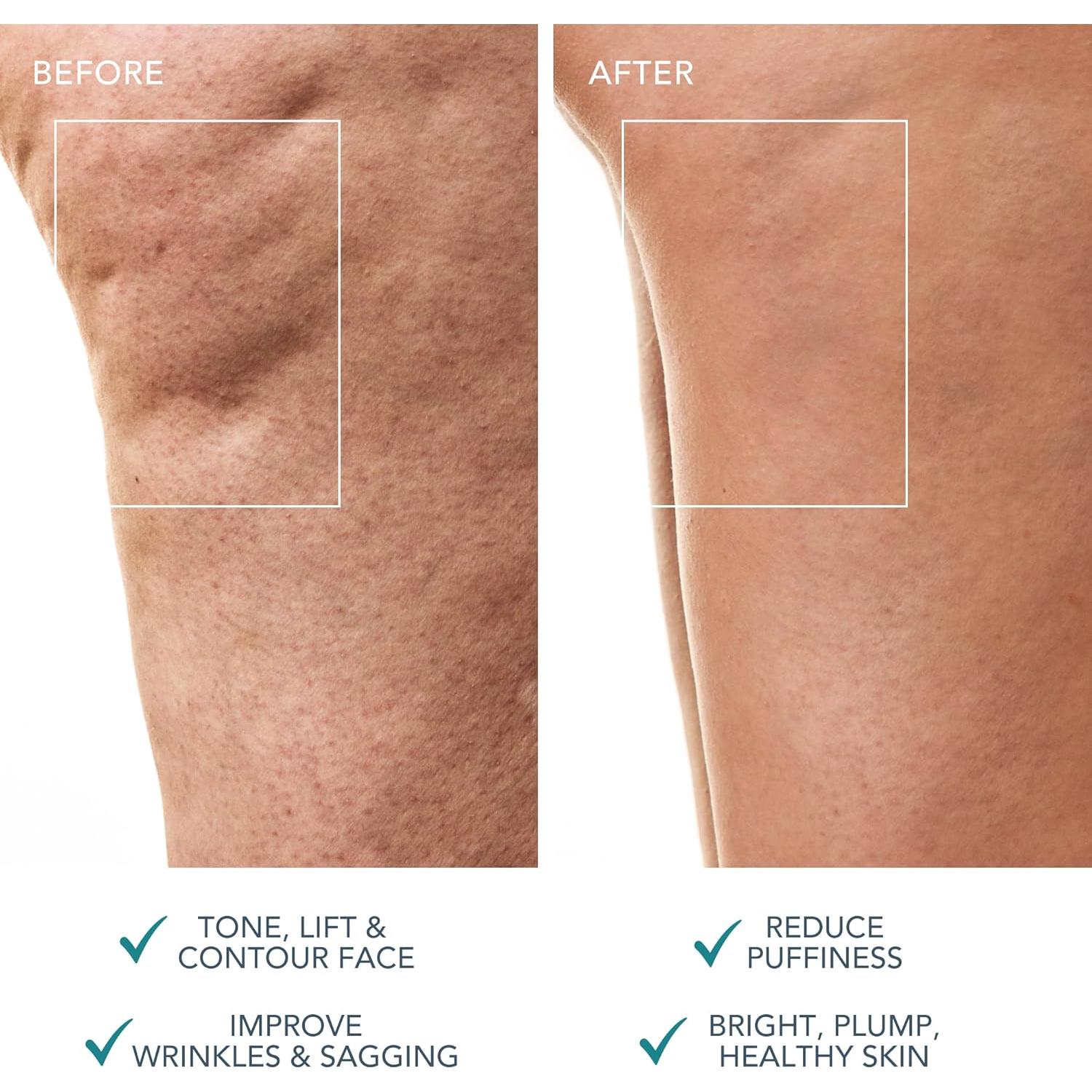 Masajeador Corporal FOREO BEAR 2 - Microcorriente Avanzada