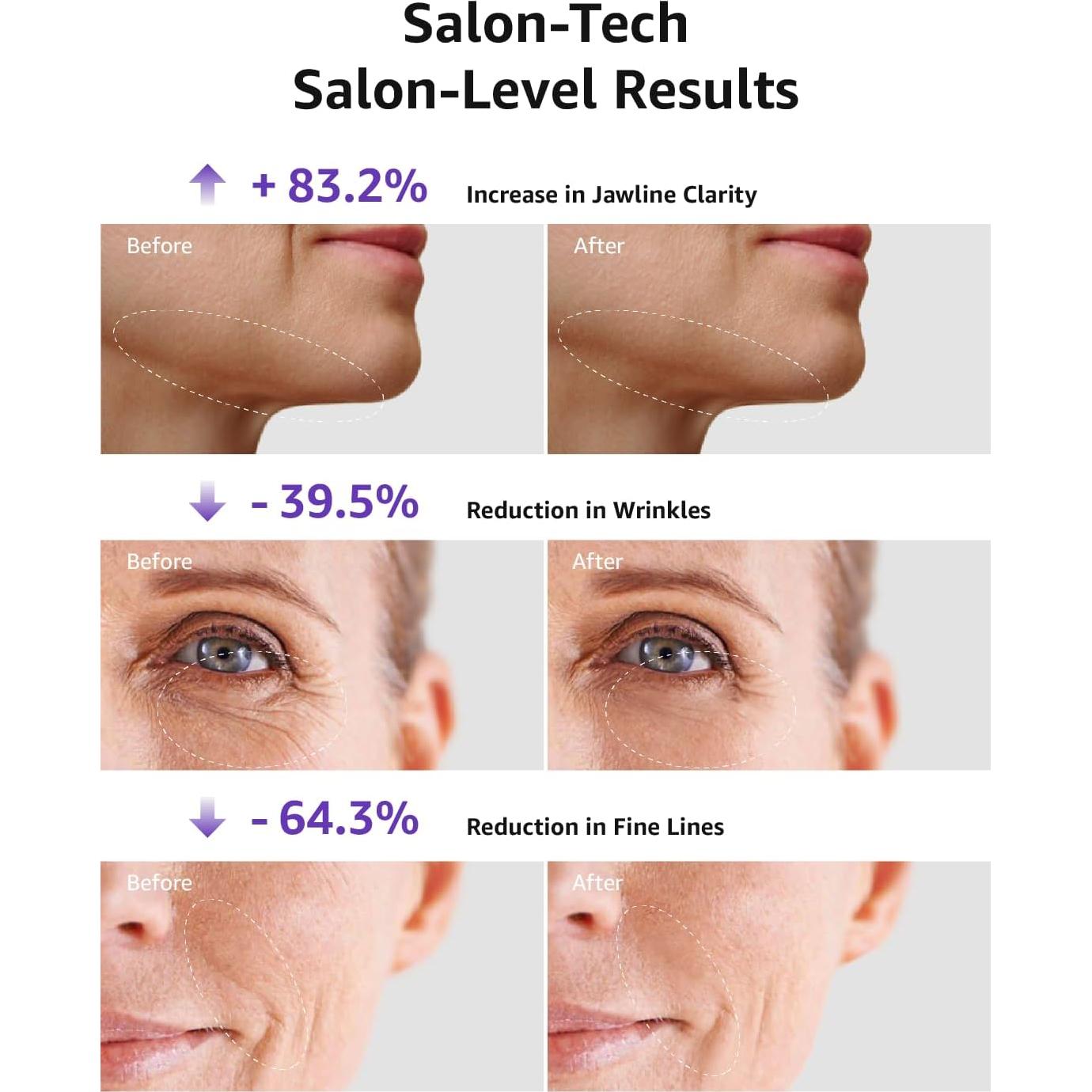 Dispositivo Facial VITALY Glow-Pro Antienvejecimiento 3 en 1