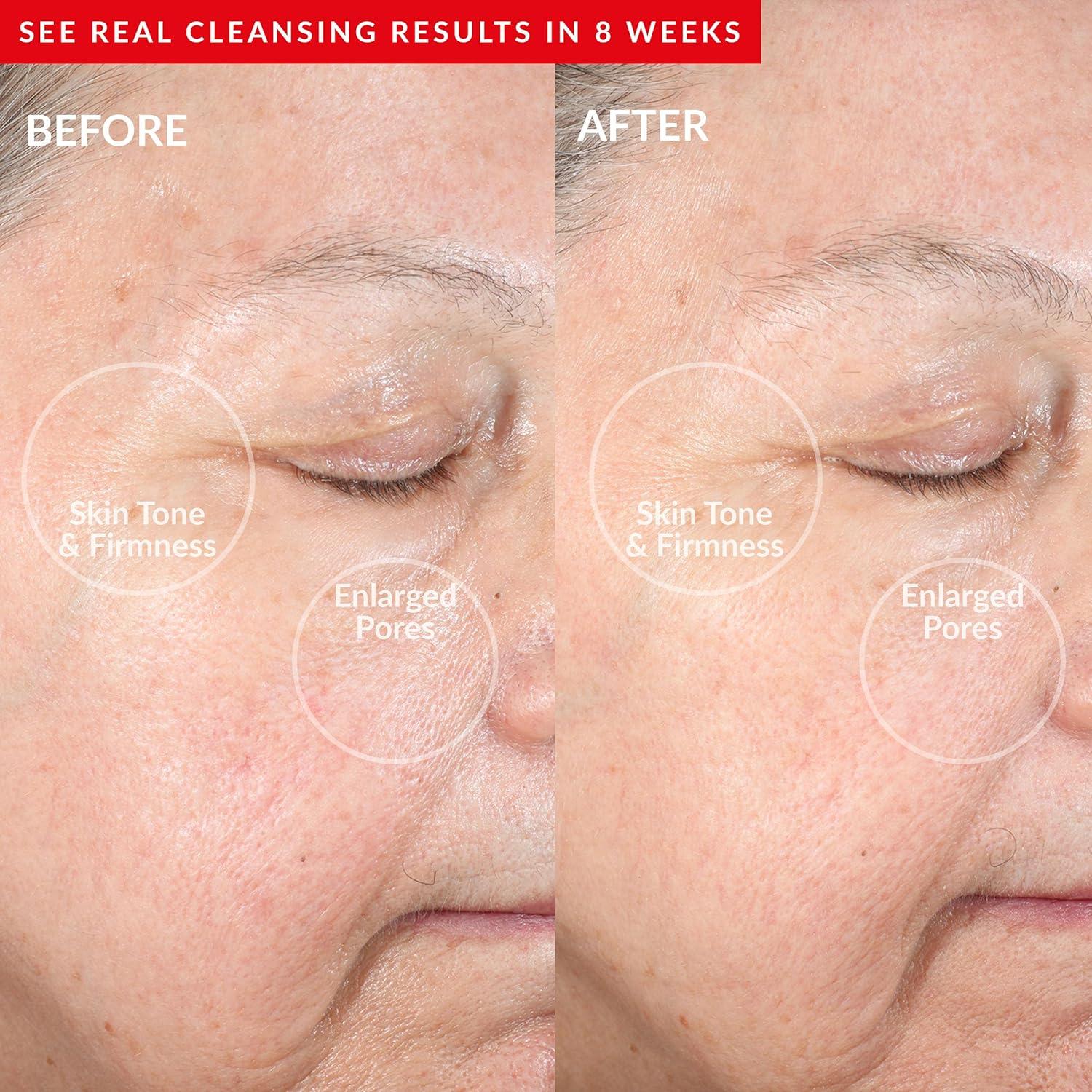 Dispositivo Facial PMD Beauty Redvolution - Cepillo Silicona y Luz Roja