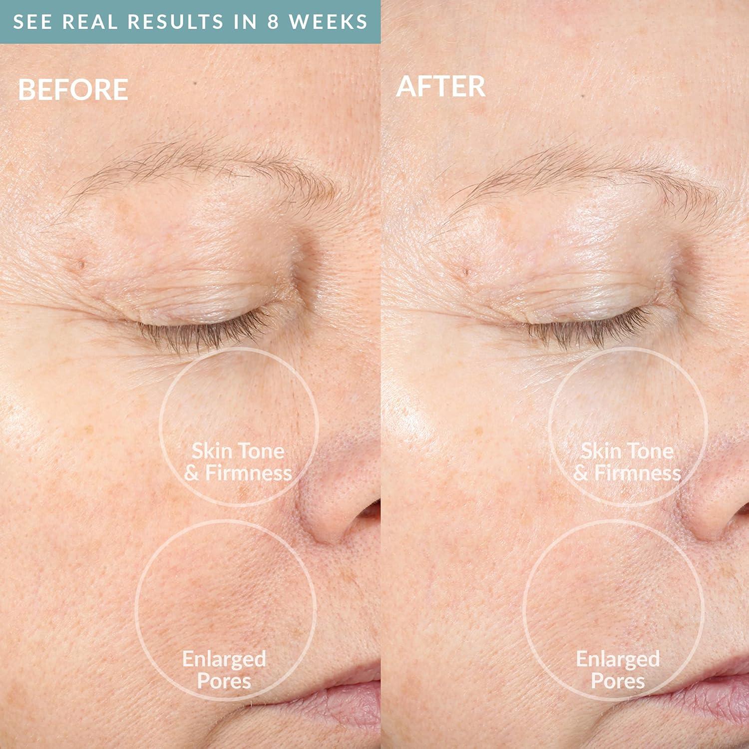 Dispositivo de Limpieza Facial PMD Belleza Pro Plata - Cepillo de Silicona y Masajeador Anti-Envejecimiento