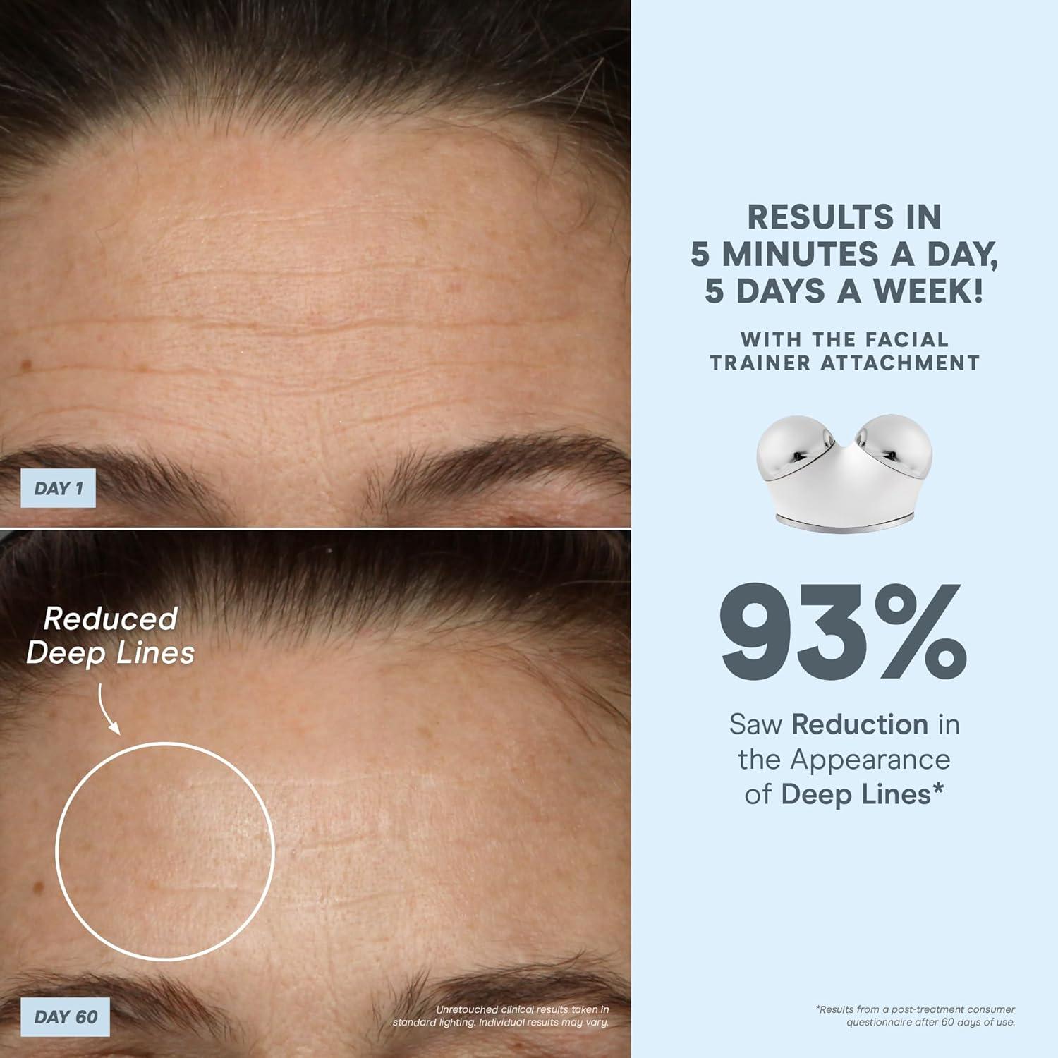 Dispositivo Facial Microcorriente NuFACE TRINITY+ Rosa Arenosa