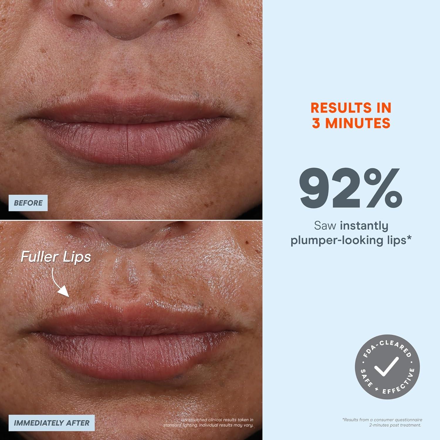 Dispositivo Facial Microcurrent NuFACE FIX Microwand - Aumento de Labios y Tratamiento para Ojos