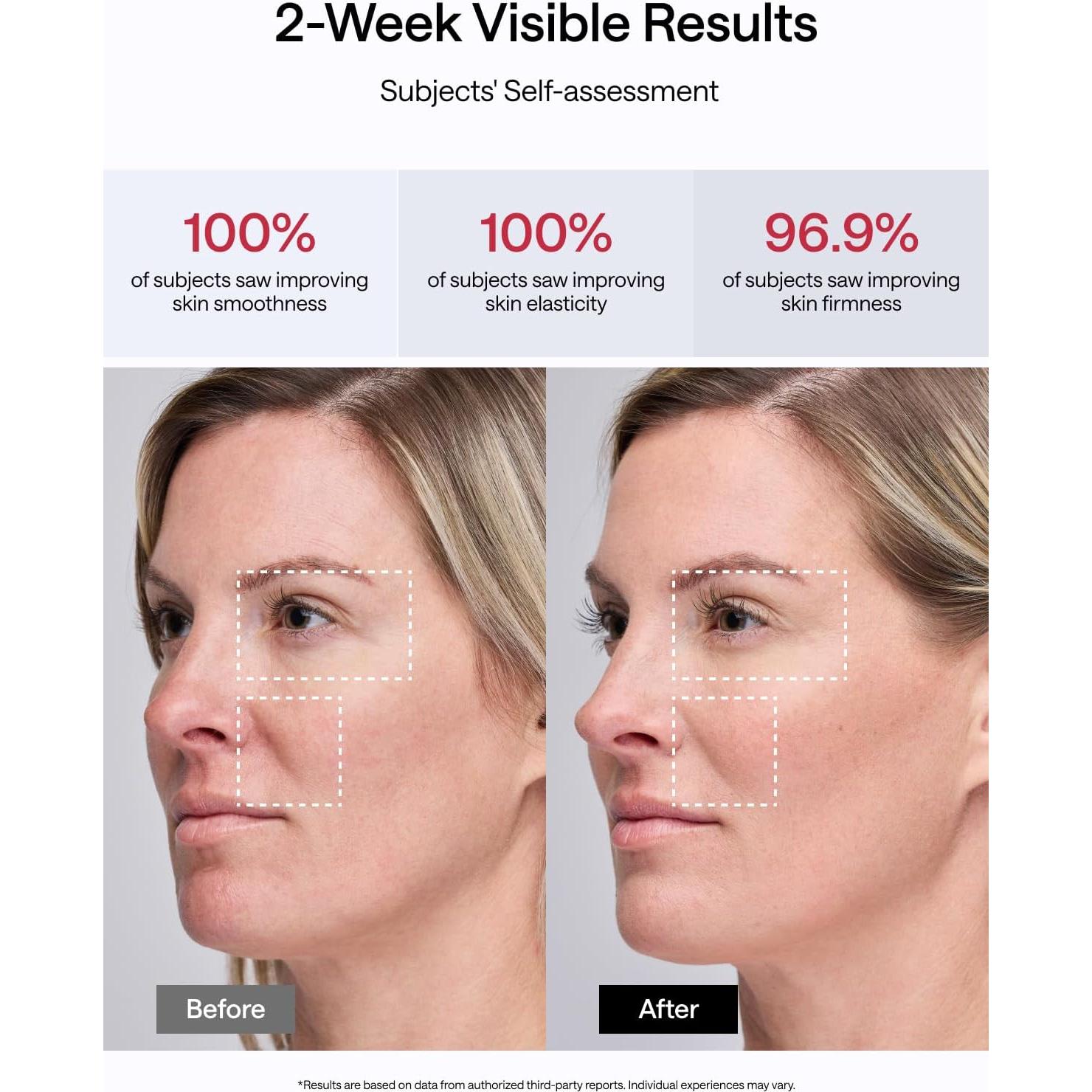 Dispositivo Facial JMOON M30U - Tonificación y Luz Roja